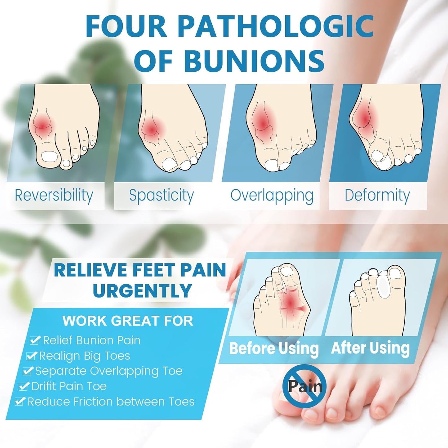 Toe Spacers(1/2"), Happiby Silicone Toe Separators for Bunion, Overlapping Toes and Toe Pain Relief, Big Toe Alignment, 5 Pairs/10 Pcs
