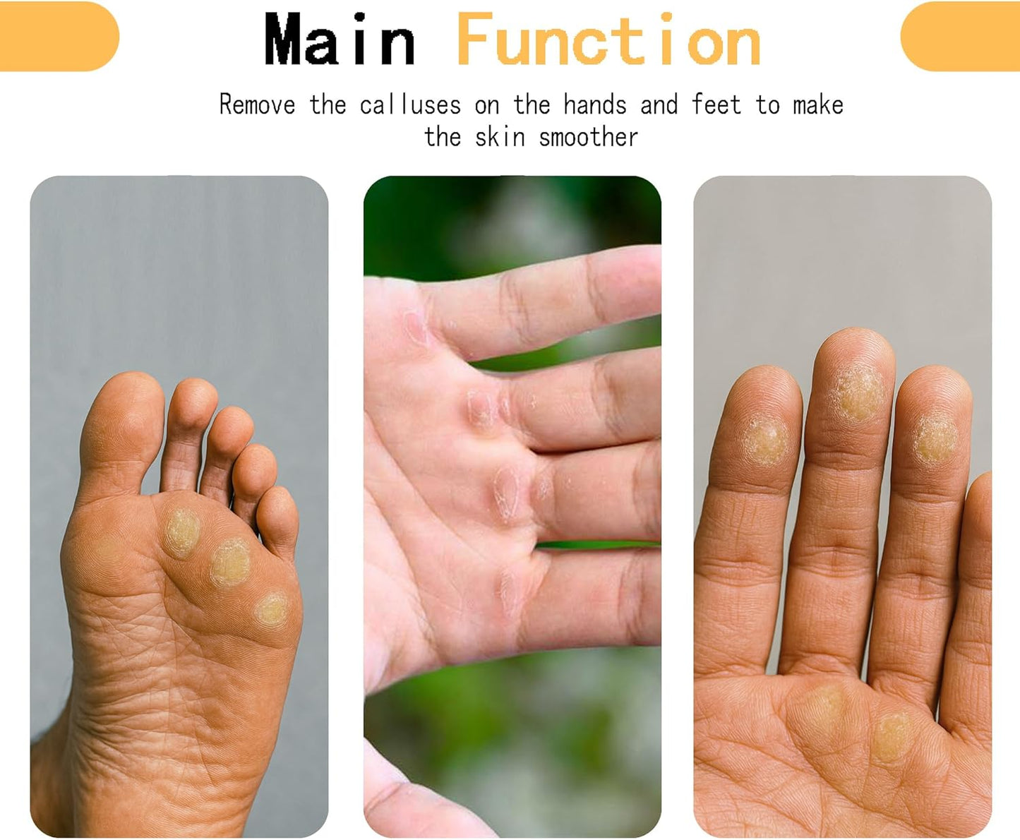 Callus Remover for Hands,Hands & Feet Callus File with 3 Grit Sandpapers (100/180/400), Durable Hand Callus Shaver for Crossfit, Climbing, Woodworking