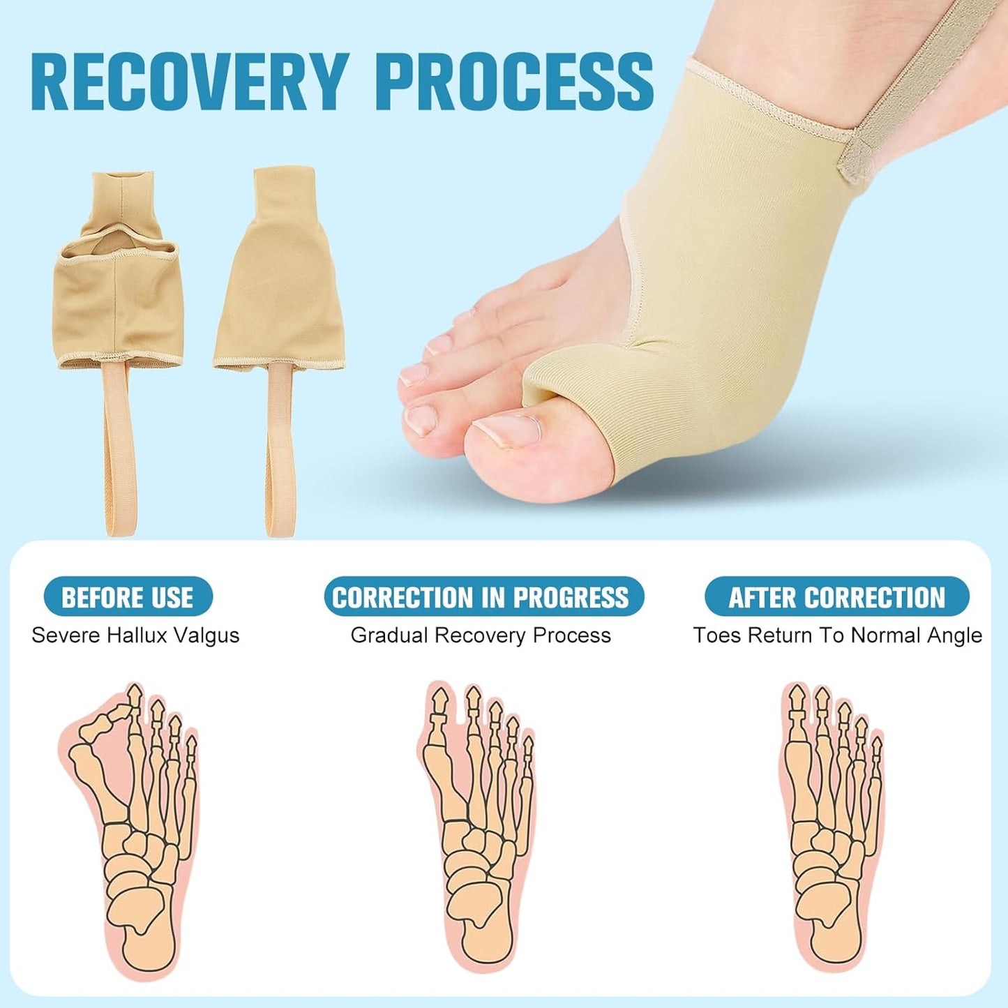 Bunion Corrector Sleeve for Women & Men - Big Toe,Bunion Pads to Wear With Shoes,Hallux Valgus Support & Discomfort Relief - Flexible Breathable Bunions Sleeve Socks for Day and Night Use (L)