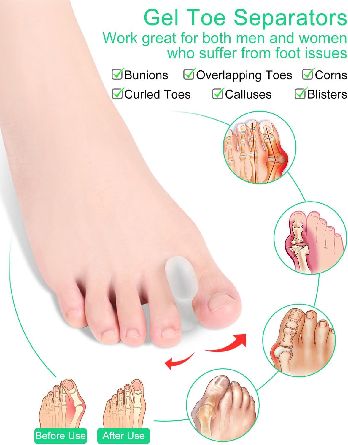 12 Pack Gel Toe Separators, Bunion Toe Spacers with 2 Sizes for Women Men Toe Pain Relief, Soft Silicone Toe Spacer for Crooked Toes, Overlapping Toes, Hammertoe Corrector(6L+6S)