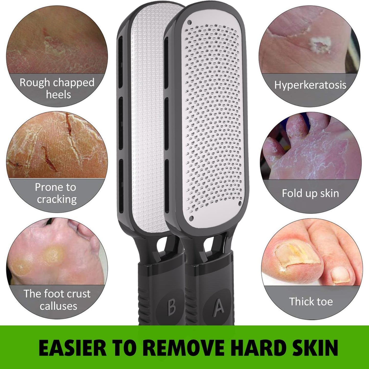 Antonki Foot File for Dead Skin, Double Sided Callus Remover for Feet, Metal Foot Scrubber for Cracked Heel, Professional Foot Scraper Rasp Pedicure Tool to Remove Hard Skin - 2 in 1 Foot File