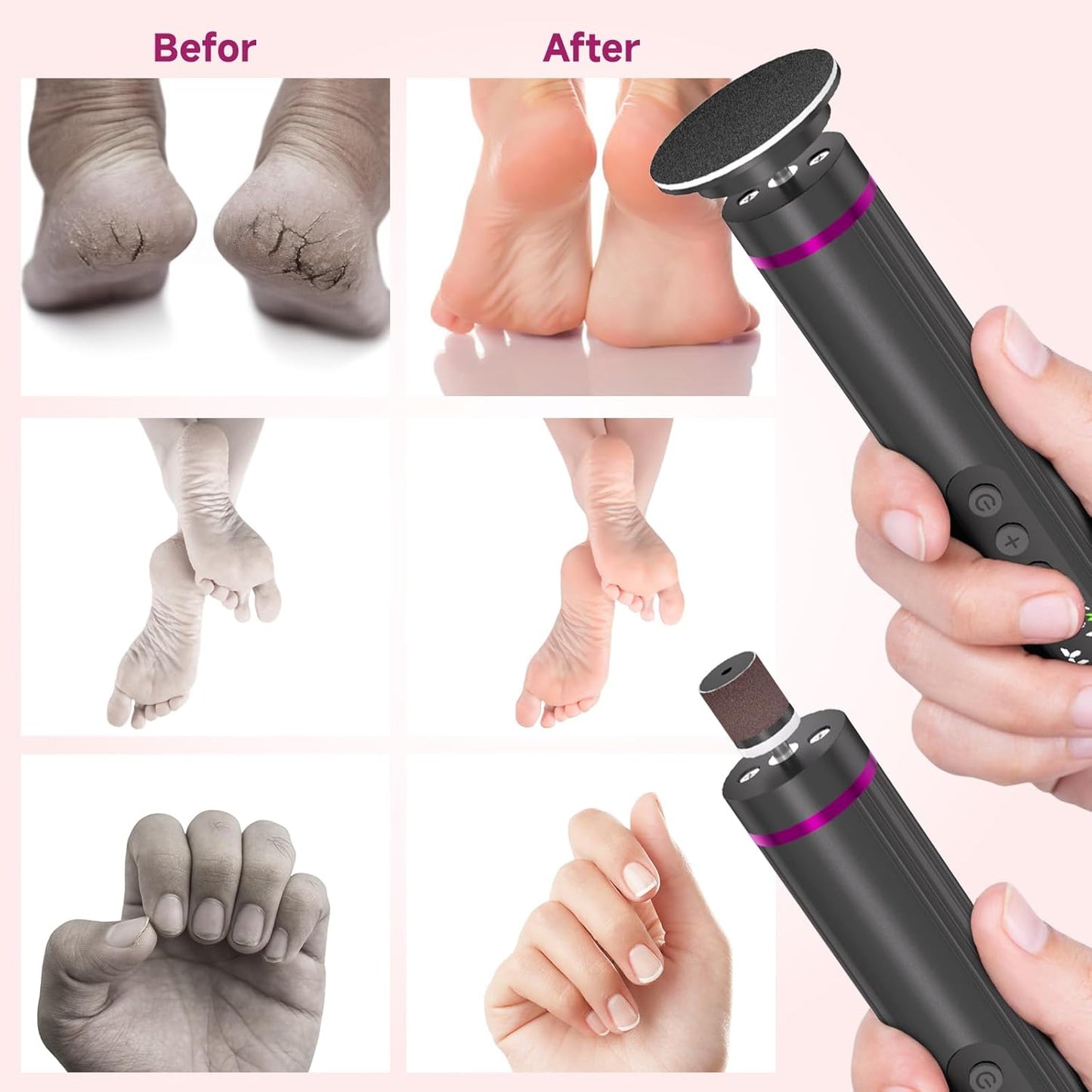 Dermave Electric Foot Callus Remover Cordless, 2 in 1 Wireless Electric Foot File, Adjustable 9 Speed Rechargeable Pedicure Foot Filer Tool w/Sandpaper Discs & Nail Drill Bits, Digital Display (Gray)
