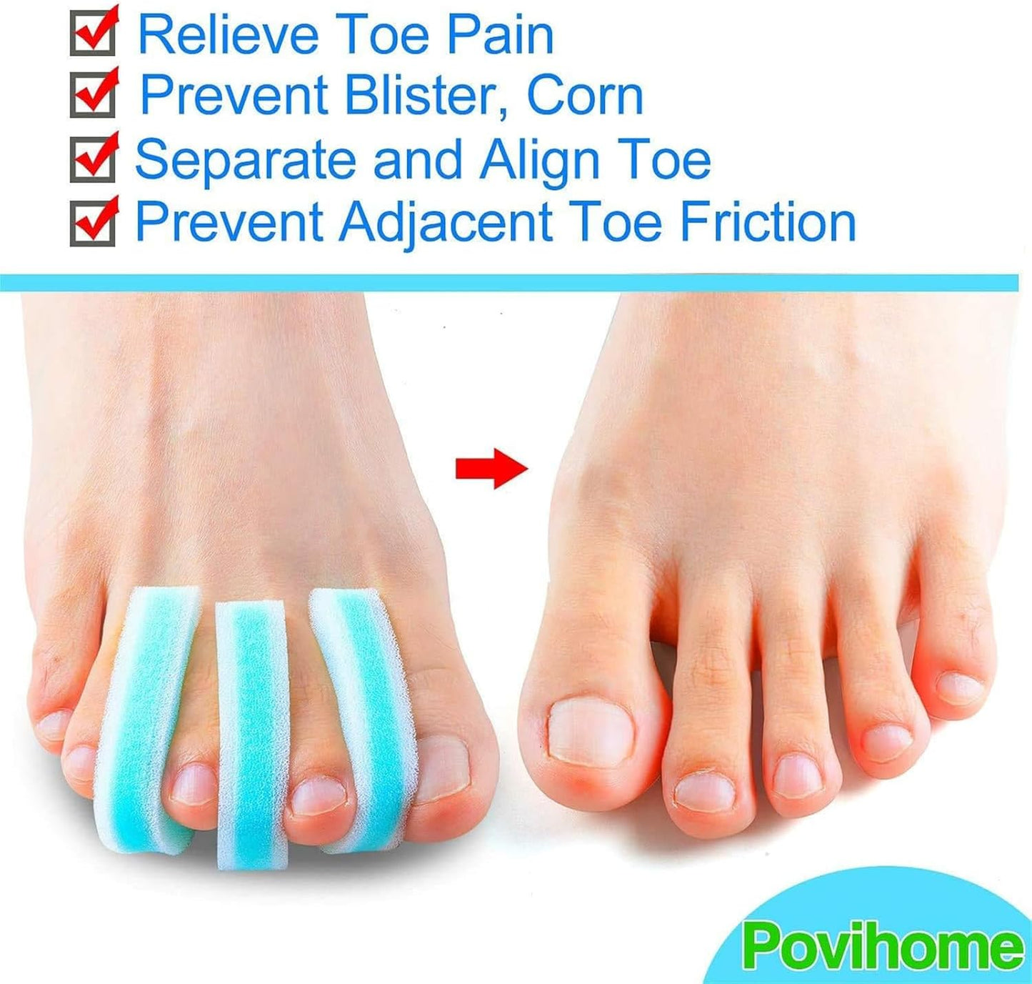 Povihome 20 Pack Foam Toe Spacers(2/5" Thick), 3-Layer Toe Separators - Large Size - to Align Crooked, Overlapping Toe, Relieve Corn, Blister and Reduce Irritation