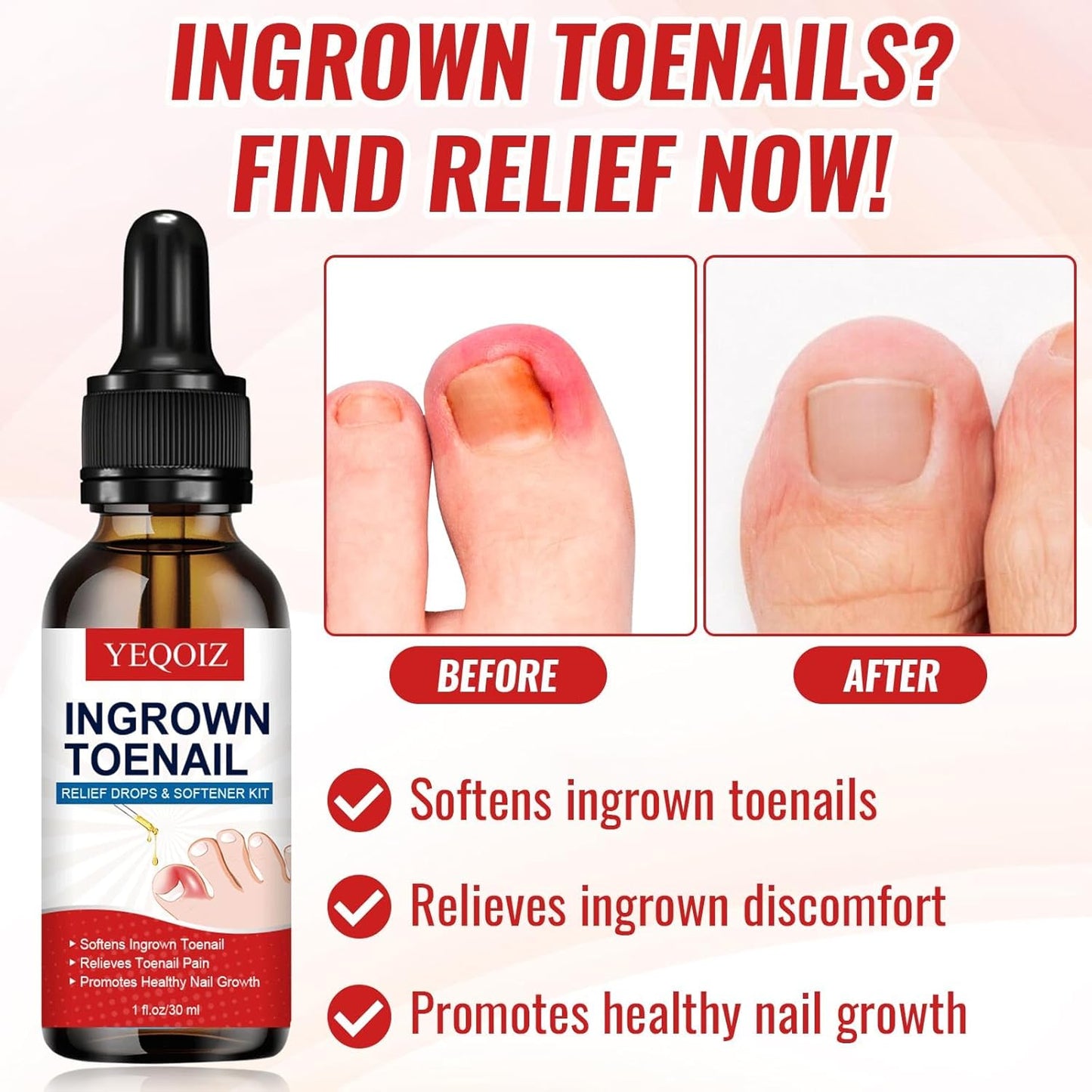 Ingrown Toenail Removal Kit, Ingrown Toenail Tool Kit with Ingrown Toenail Corrector, Ingrown Toenail Drops, Corrector Patch, Toenail Clipper, Nail File Lifter Tools