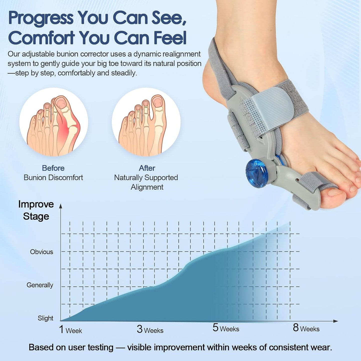 Bunion Corrector for Women Men Big Toe,Adjustable Knob Bunion Corrector for Bunion Relief,Bunion Fix with Bunion Silicone Pad,Suitable for Left and Right Feet(1PCS)
