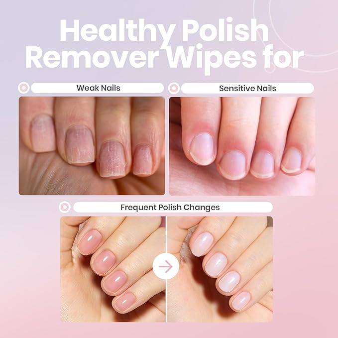 Beetles Nail Polish Remover Pads - Nail Scrubbers (10 Count) 2-in-1 Prep & Lacquer Remover Nail Wipes - Travel-Friendly Fingernail Polish Remover with vitamin E