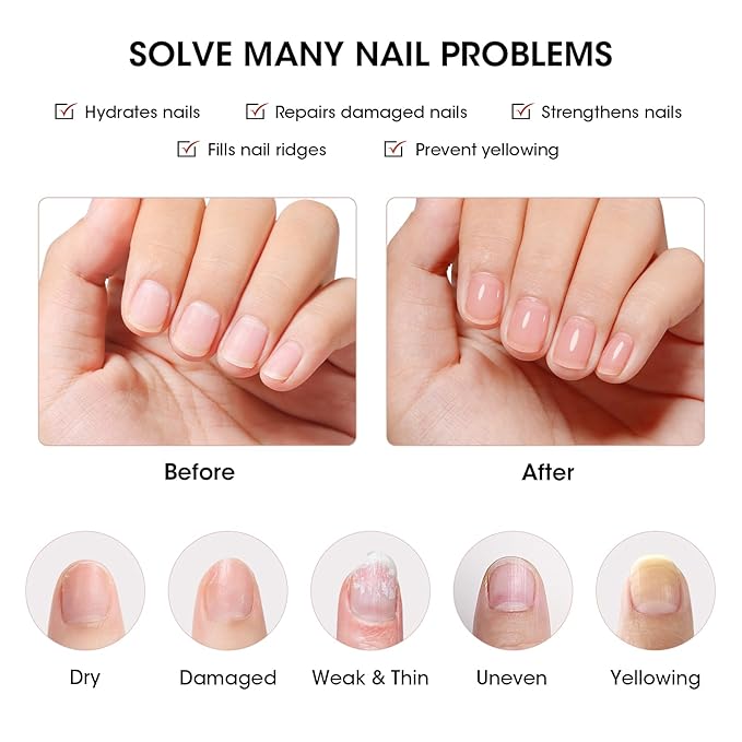 GELLEN Tinted Red Ridge Filler For Nails, Clear Nail Polish Ridge Filling Base Coat, Nail Strengthener and Growth, Hydrates Strengthens Nourishes Damaged Dry Nails, Shea Butter & Vitamin E & Protein