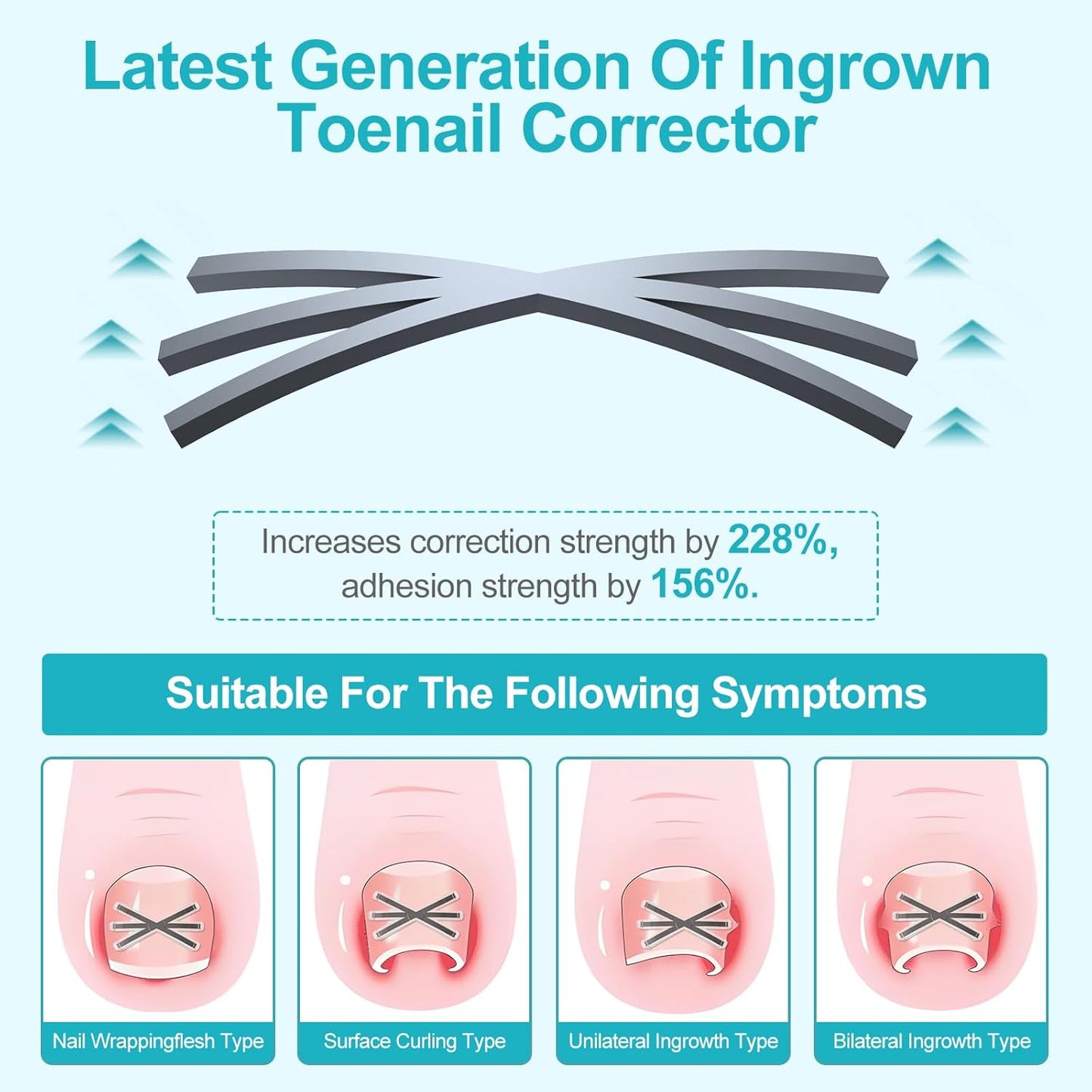 Ingrown Toenail Treatment Kit with Upgraded 6-Angle Shape,Titanium Alloy Ingrown Nail Corrector Tools with 4 Multi-Sizes,Ingrown Toe Nail Relief Remover Strips for Curved Toenail Quick Relief,8Pcs