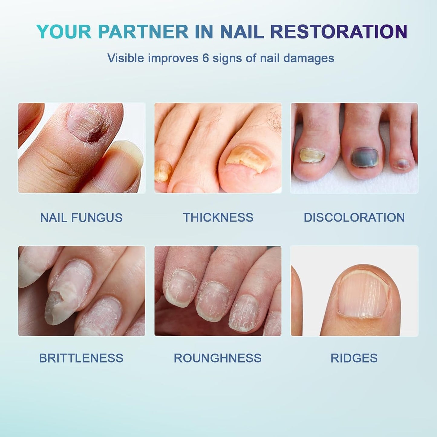 Fungal Nail Patches - 32 PCS, Toenail Fungus Treatment Extra Strength for Thick, Brittle and Discolored Toenail, Nighttime Care with Natural Ingredients, Nude-Colored Patches (Blue)