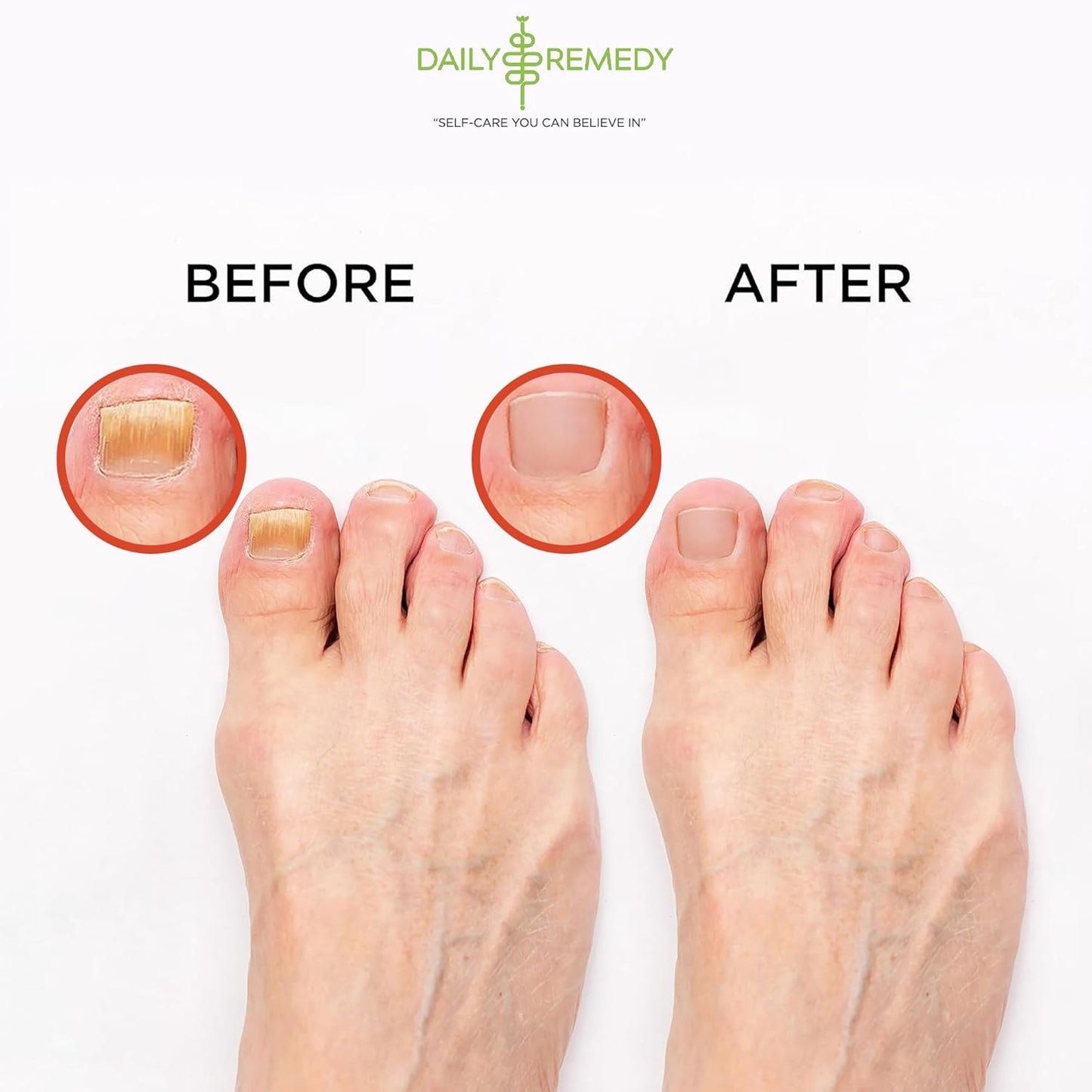 Muscle Relief Foot Soak with Epsom Salt, Made in USA, Soothe Tired Feet, Softens Calluses and Helps Athletes Foot 1lbs