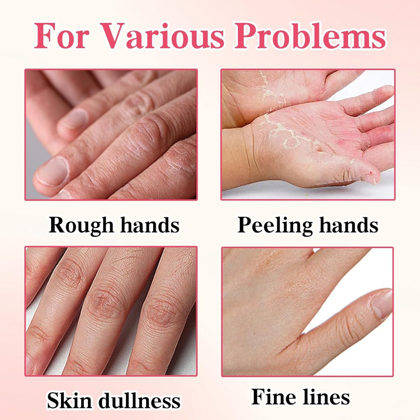 6 Pcs Hand Masks Moisturizing Glove, Hydrating Hand Mask for Dry cracked Hands, Exfoliating Collagen Gloves for Smooth Hands, Smooth Exfoliating Hand Peeling Mask