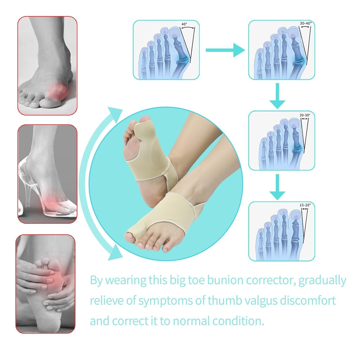 Bunion Relief Sleeves Bunion Pads Brace Cushions Toe Straightener with Silicone Gel Big Toe and Pinky Separator Spacer Hallux Valgus Relief Kit Pack (Large)