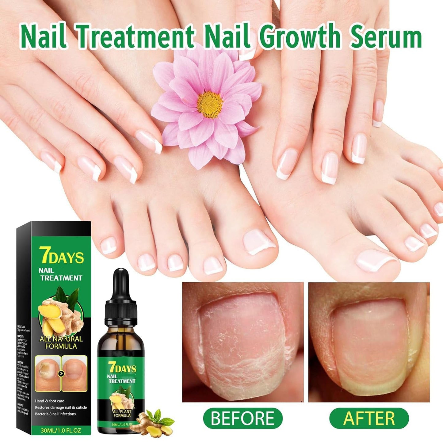 Ginger Nail Treatments, 7 Days Ginger Cuticle Care Oil for Nails for Strengthen nails & Promote Nail Growth, Natural Plant Formula（2PCS)
