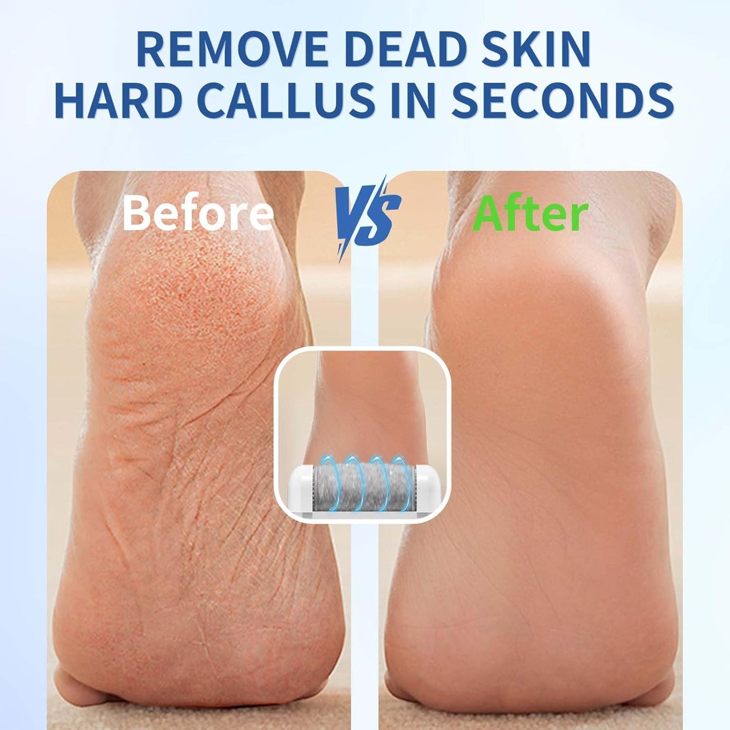 Rendoo Rechargeable Callus Remover for Feet - Cordless Foot Sander & Callus Grinder for Dry Cracked Heels, Electric Foot File with 3 Roller Heads for Smooth Feet, Battery Operated