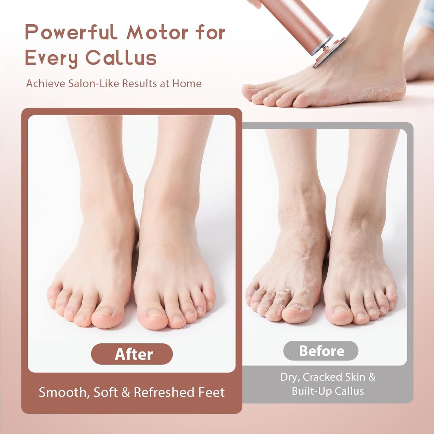 Electric Foot Callus Remover with 60pcs Sandpaper Discs, 4.8IN Aluminum Foot File for Dead Skin and Cracked Heels, 800RPM Professional Pedicure Tool for Home Spa Use