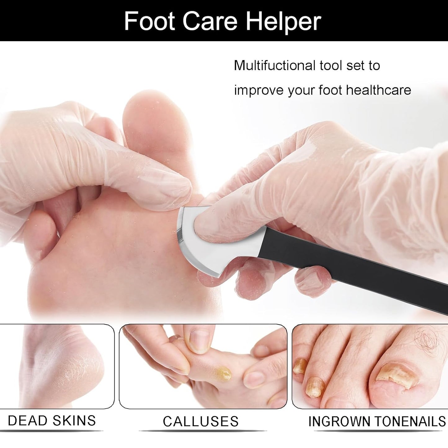 Segbeauty 7pcs Ingrown Toenail Removal Kit, Professional Pedicure Tools for Feet, Callus Shaver Cuticle Remover Kit with Storage Bag, Foot Corn Remover Home Pedicure Knife with Knife Sharpener Stone