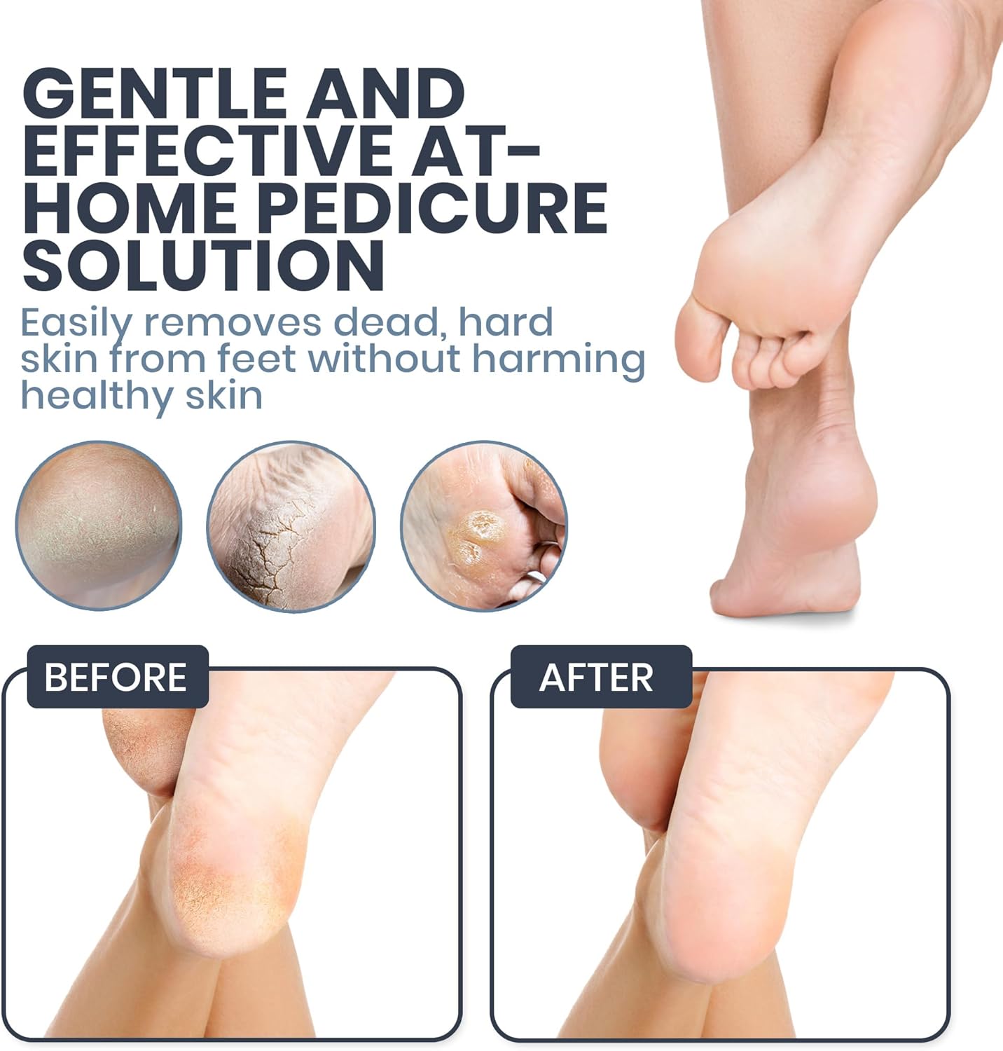 Upgraded 2025 Electric Foot File – Callus Remover for Women & Men with Adjustable Speed, 60 Sanding Pads & Dead Skin Exfoliation – at-Home Pedicure Tool for Dry, Cracked Feet(Black)