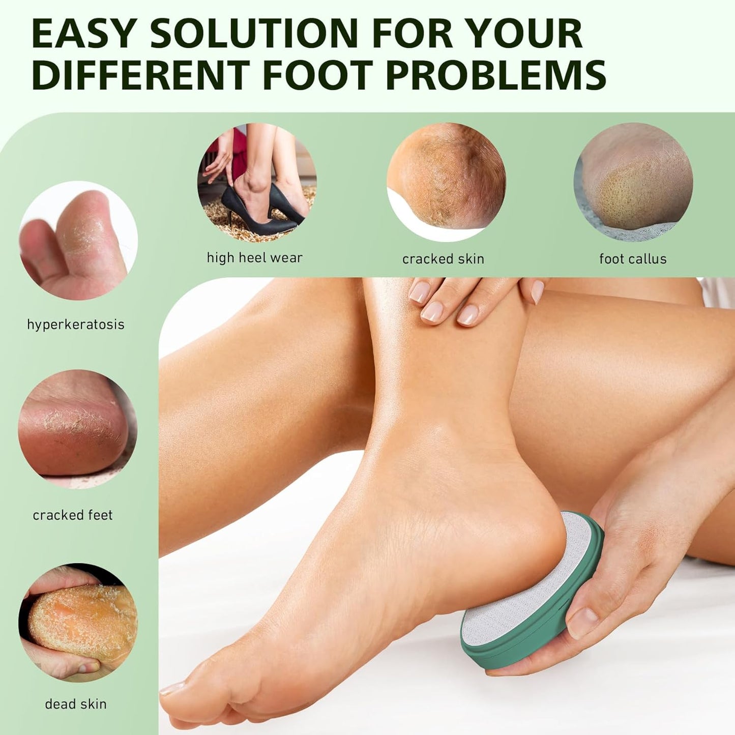 BALUCA Glass Foot File Callus Remover for Feet - Nano Glass Foot Scraper Scrubber Dead Skin Removal for Cracked Heels,Professional Pedicure Tool for Home, Salon, and Travel (Green)