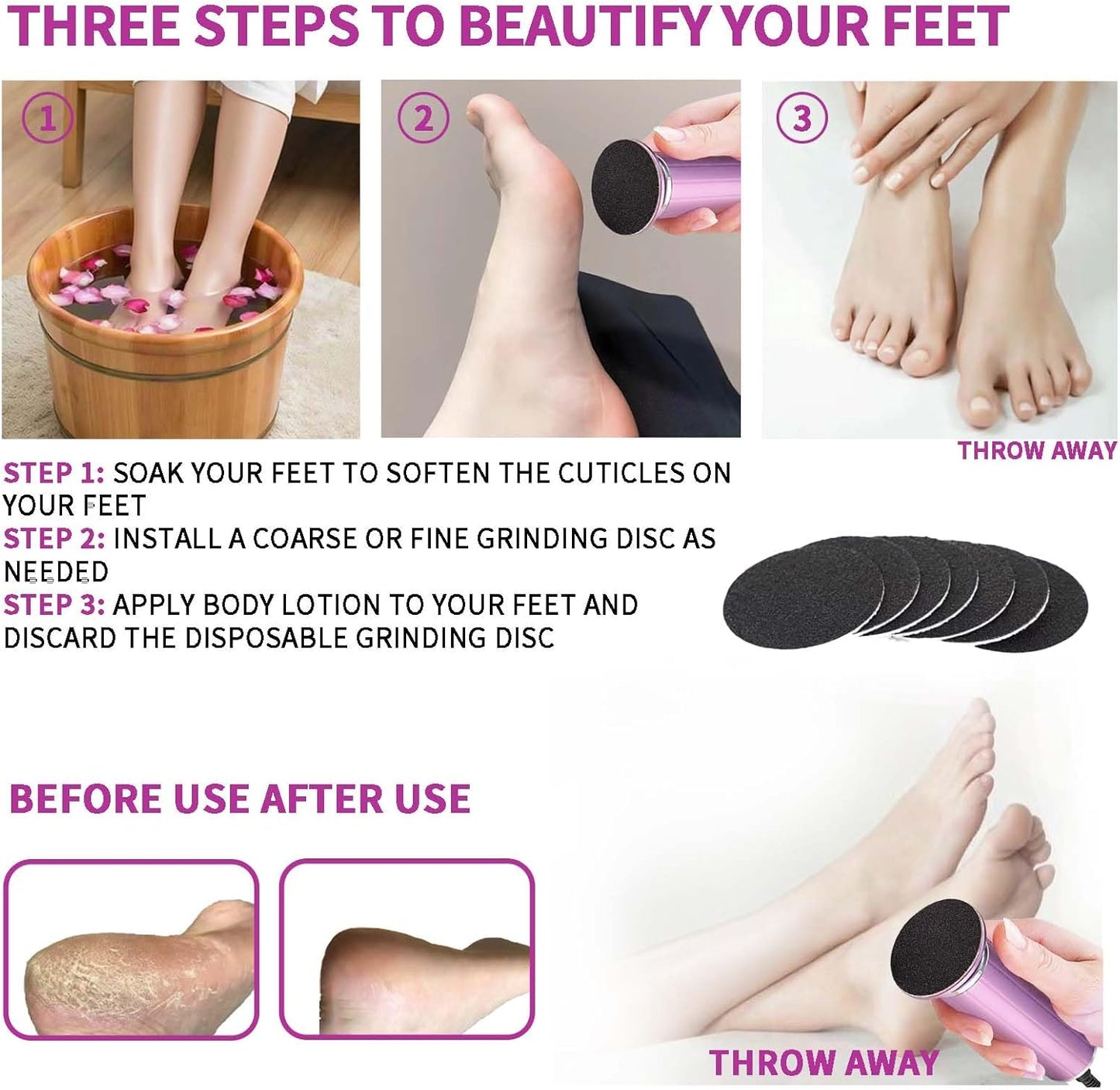 Electric Callus Remover for Feet, USB Power Supply Electric Foot File Sander Scrubber with Speed Controller 60Pcs Replacement Sandpaper Disk for Dead Skin, Cuticles