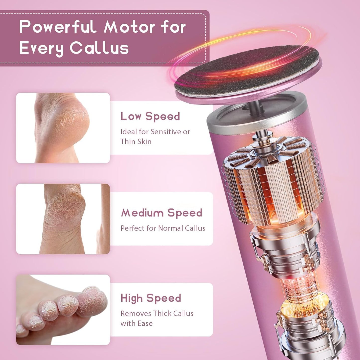 Electric Foot Callus Remover with 60pcs Sandpaper Discs, 4.8IN Aluminum Foot File for Dead Skin and Cracked Heels, 800RPM Professional Pedicure Tool for Home Spa Use