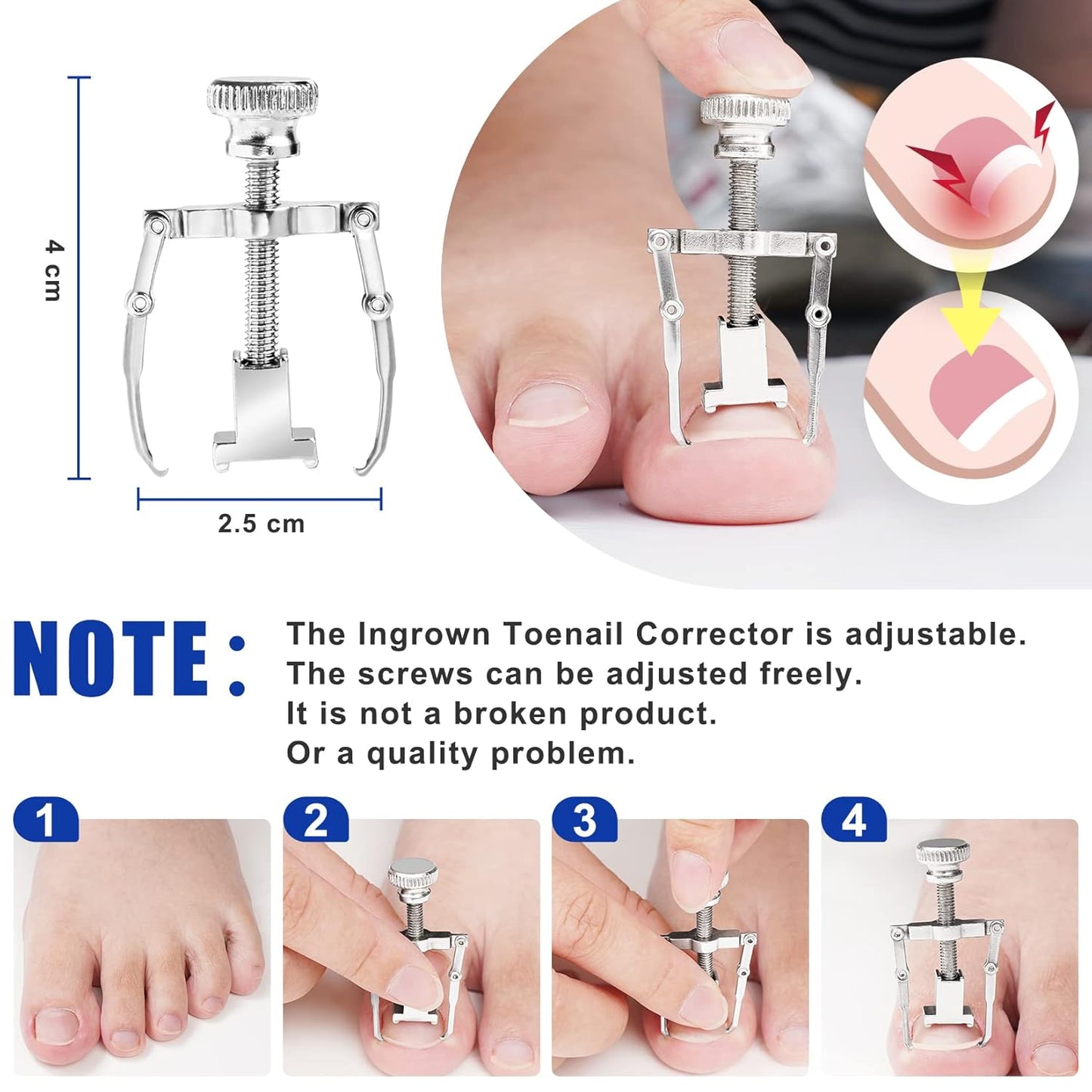 JTIEO Ingrown Toenail Tool 7PCS Upgraded Toenail Clippers Ingrown Toenail Treatment Pedicure Tools Professional Tool Set for Ingrown & Thick Nail Stainless Steel Ingrown Toenail Removal Kit