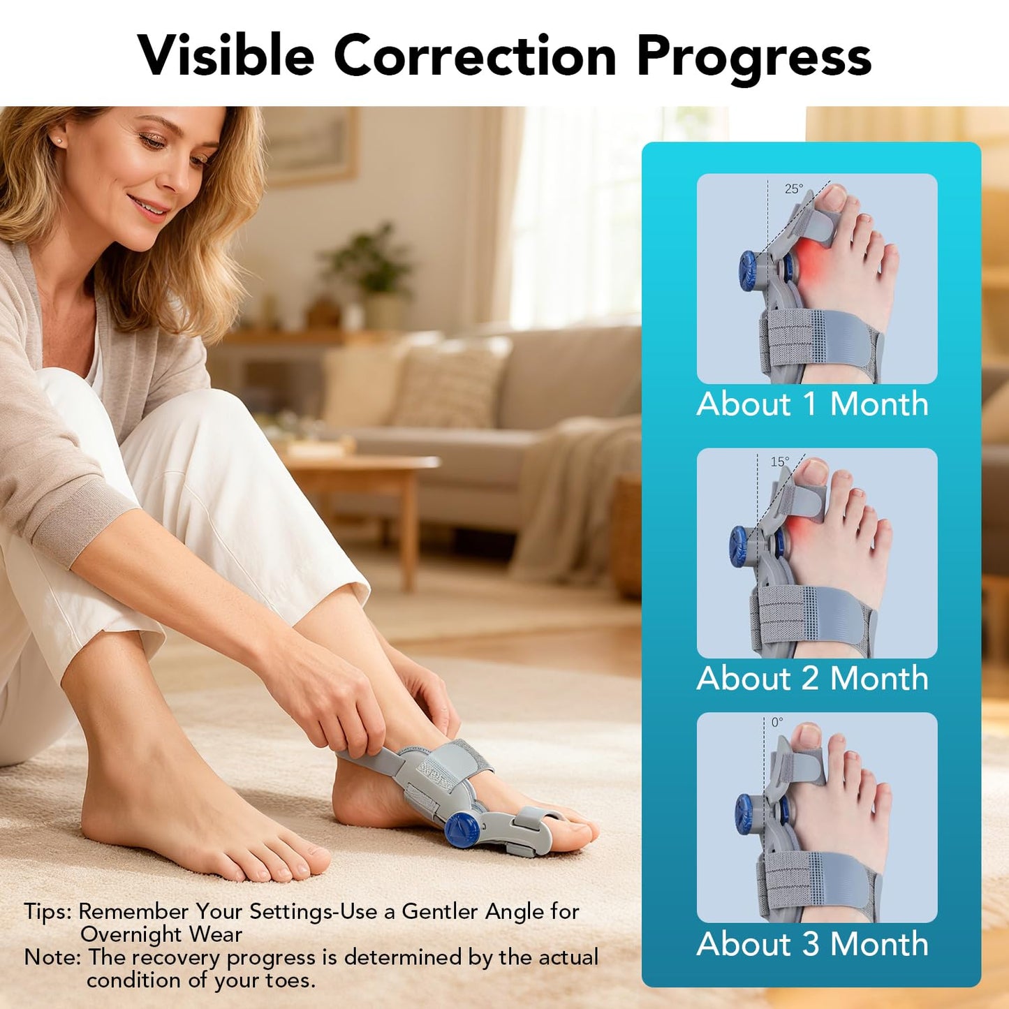 Bunion Corrector for Women Big Toe, Upgraded Adjustable Fix Bunion Relief, Men Big Toe Separator with Soft Gel Pad for Left/Right Feet Fit for All Foot Sizes (Gray 1Pcs)