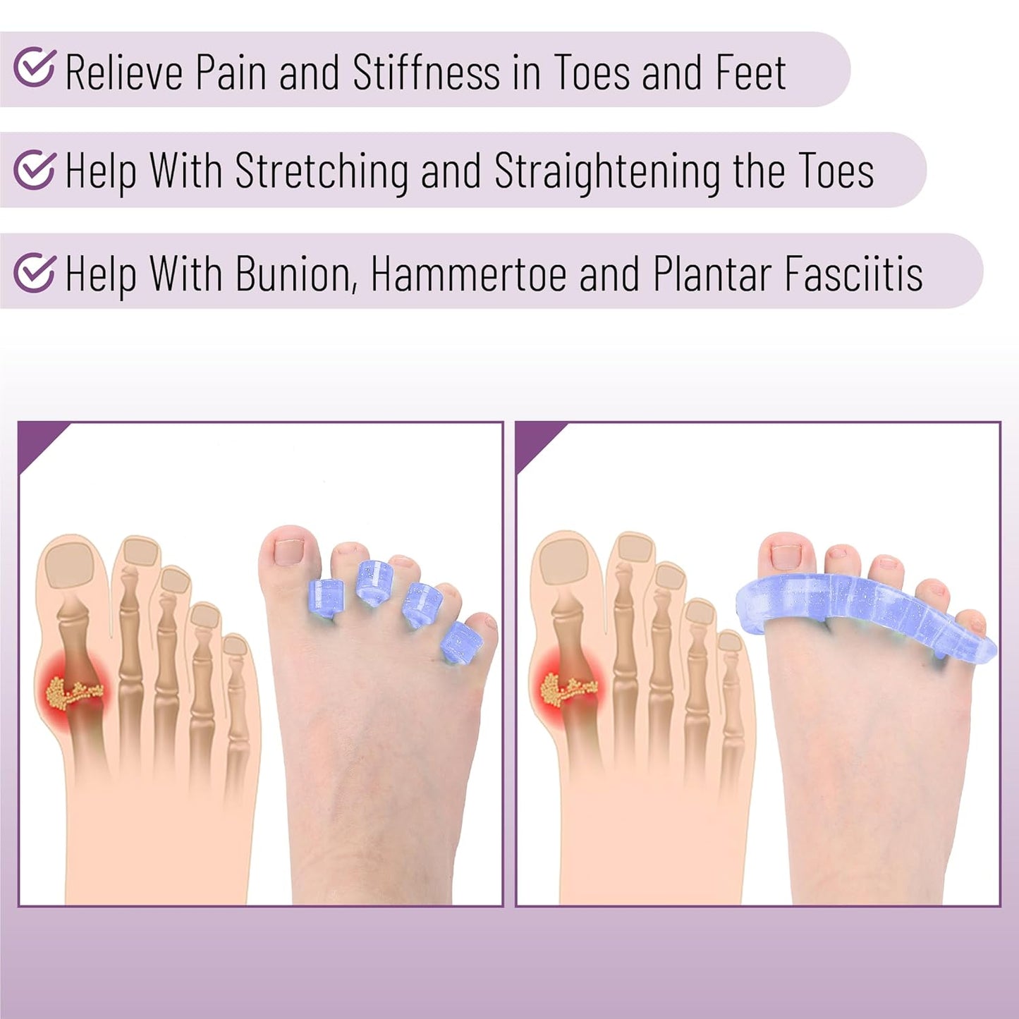 Dr. JK- ToePal Gel Toe Separator, 4 Pairs, Toe Spacers, Bunion Corrector, Blue & Purple, Christmas Gifts