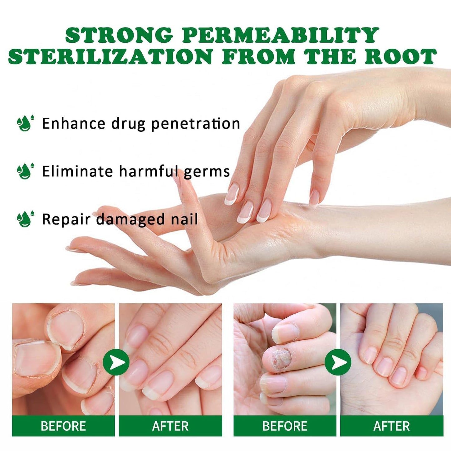 Natural Nail Treatment Gel, Nail Growth Serum for Repair & Strengthener (2)