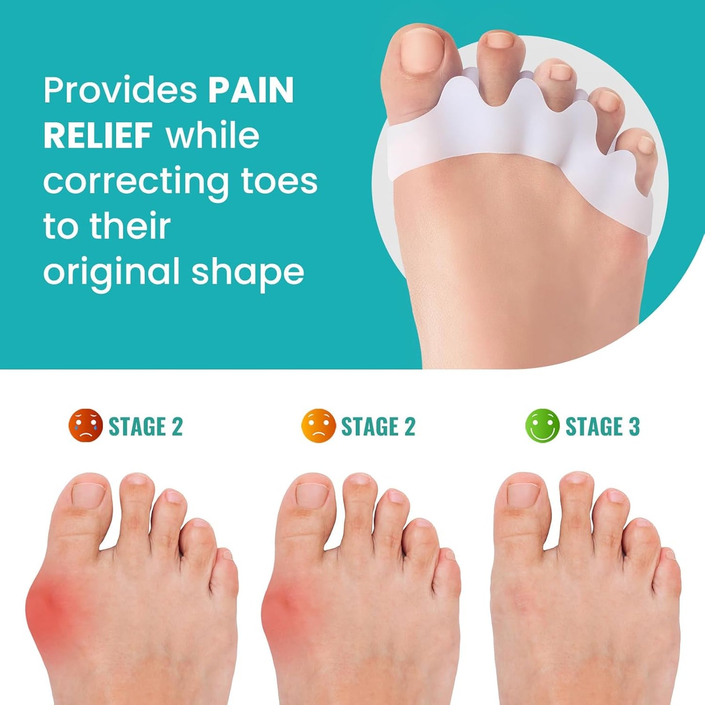 Toe Spacers & Separators - 8-Pack Bunion Corrector for Toe Alignment & Toe Pain Relief - Toe Separators for Women & Men - Toe Spacers for Gifts with Gel Cushion (White) - FSA HSA Eligible - M