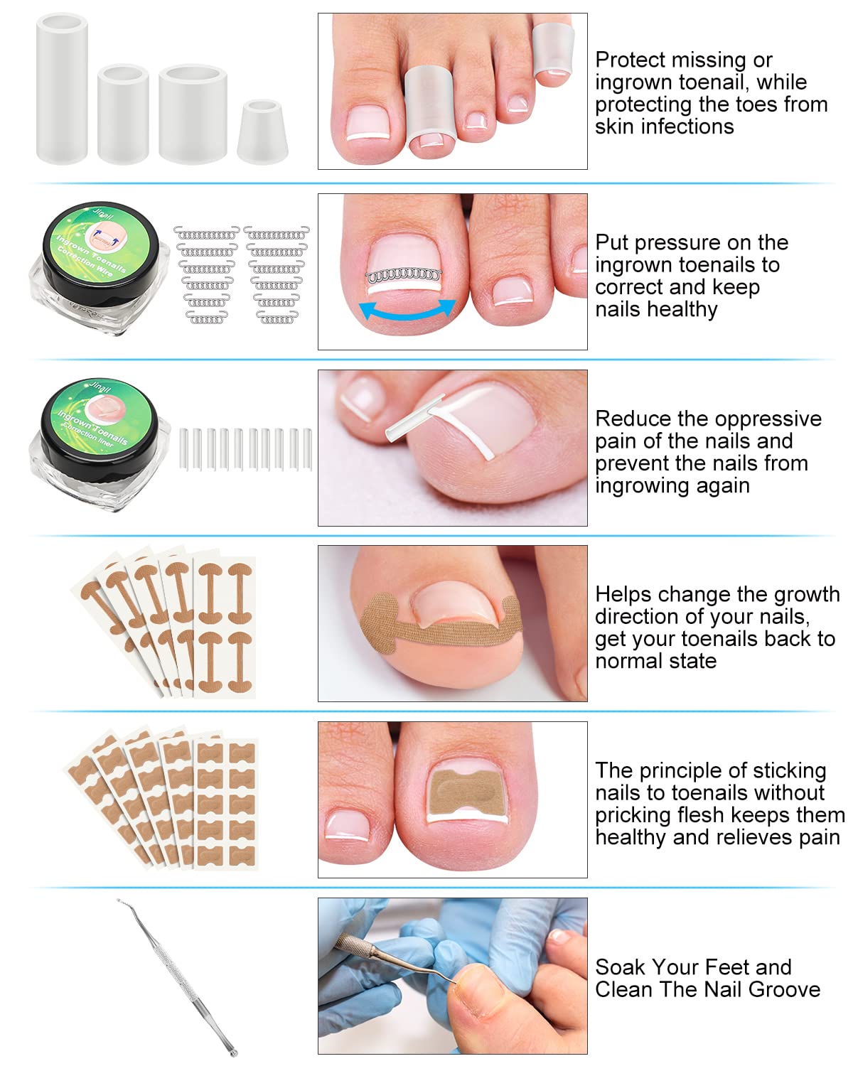 Ingrown Toenail Removal Kit, Ingrown Toenail Treatment, Ingrown Toenail Corrector Tools Come with Podiatry Toenail Braces, Ingrown Toenail Corrector Strips and Patch for Toe Pain Relief