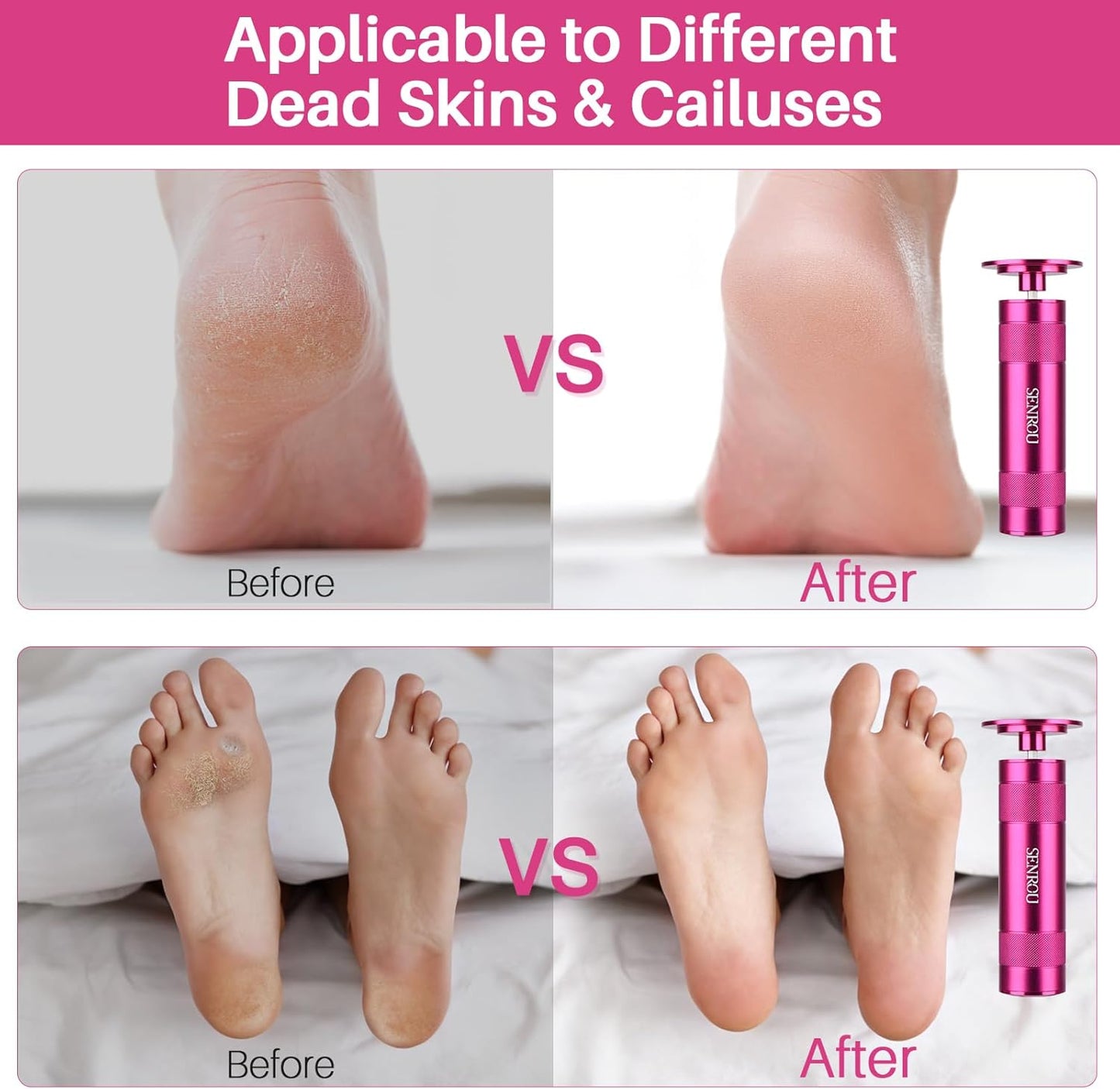 Electric Foot File Tool - Callus Remover for Feet, 2-in-1 Nail Grinder, Adjustable Speed with 60 Sandpaper Discs, Rose