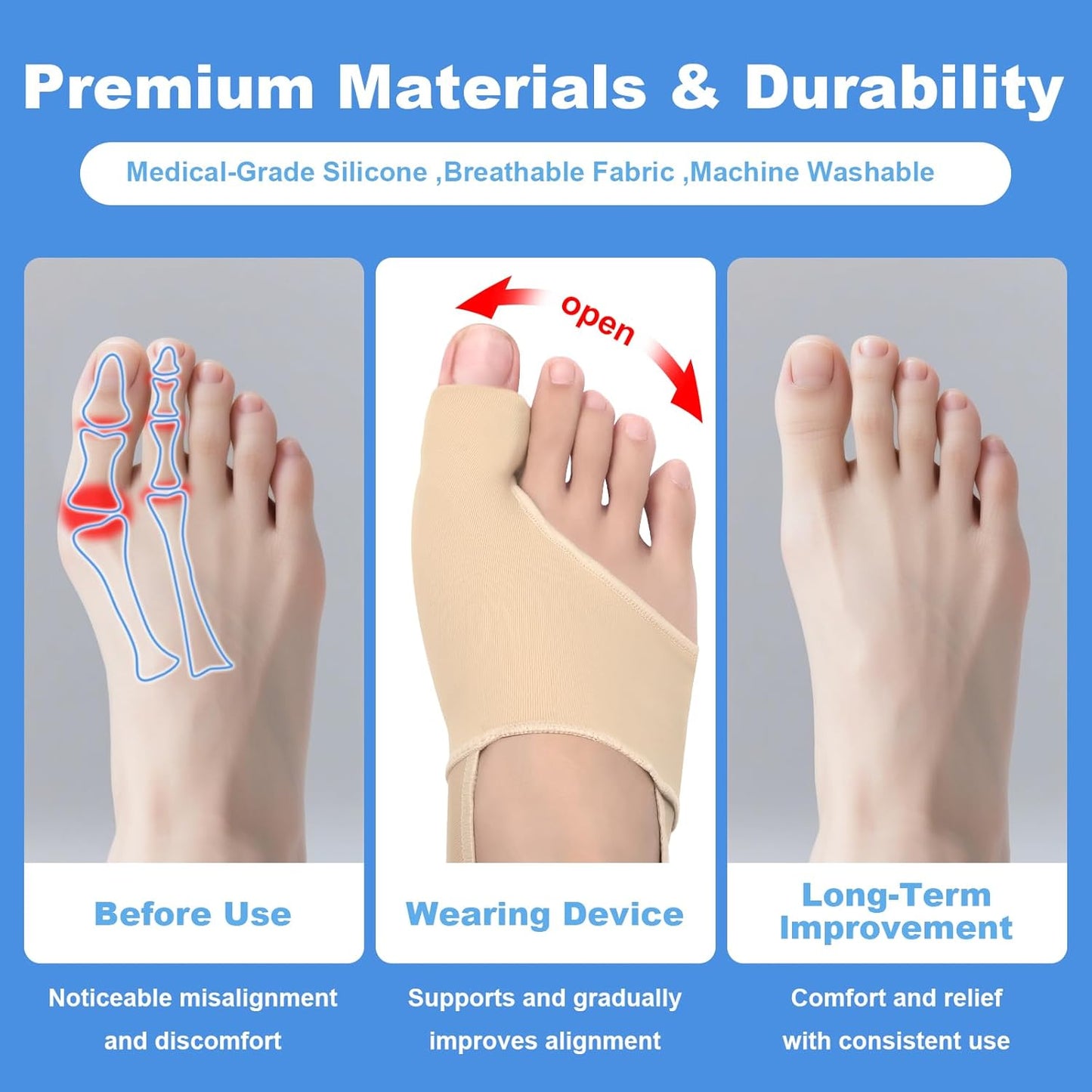 2-Pack Bunion Corrector for Women & Men | Big Toe Straightener Splint with Silicone Spacers | Relieves Hallux Valgus, Bunion Pain & Bursitis | Day & Night Use