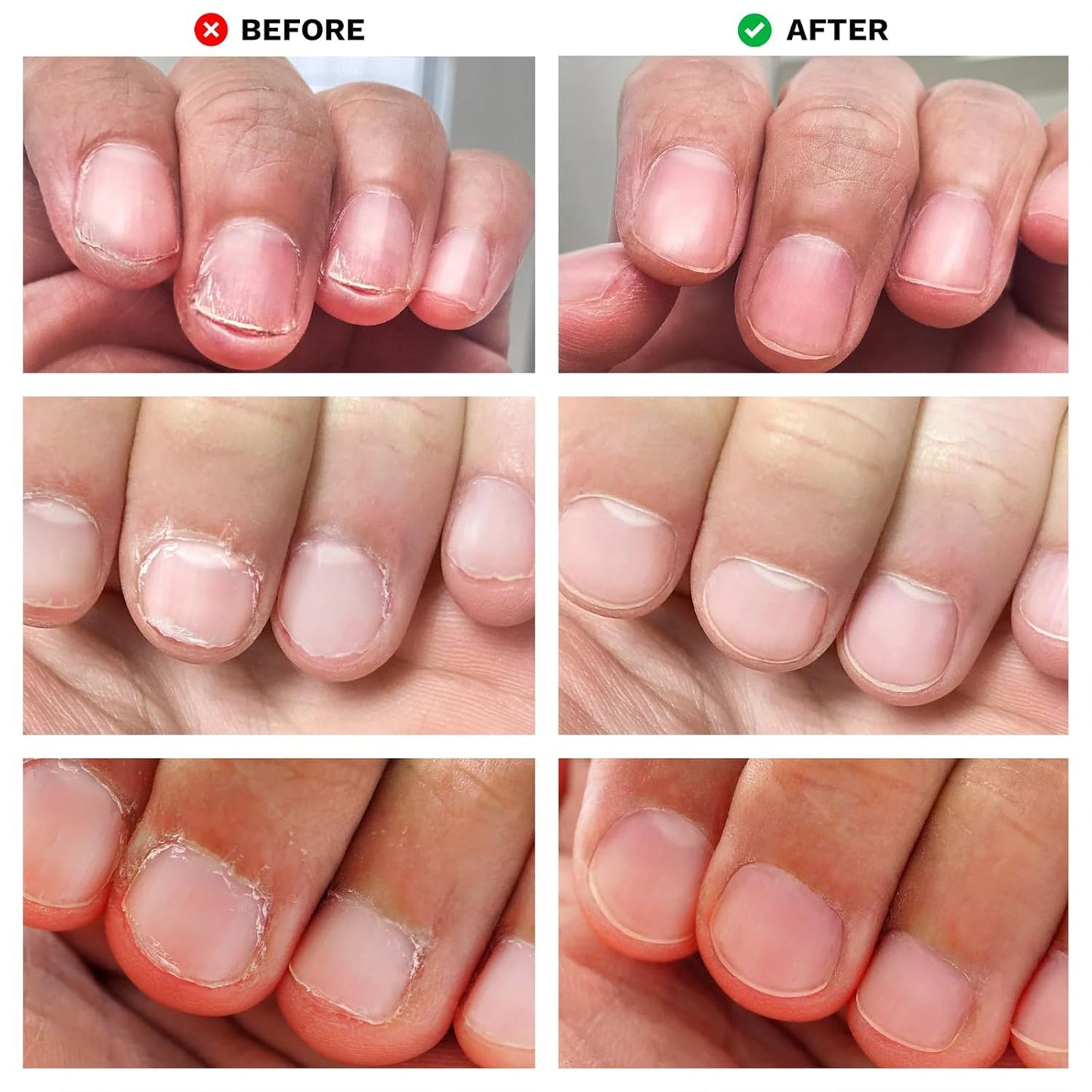 Nails Spray Fast-Drying Nail Care Moisturizer with No Odor Formula for Men & Women, Safe Mild Ingredients, 30ml/1fl oz