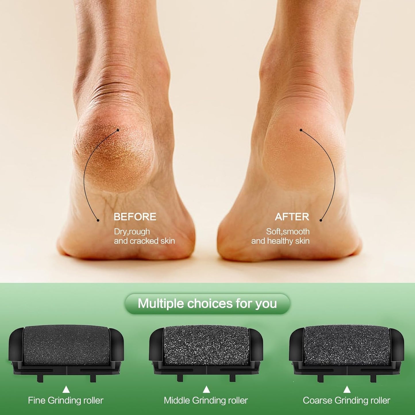 Electric Foot File Pedicure Feet Hard Skin Remover Foot Scraper Dry Dead Skin Remover Callus Exfoliator Rechargeable Feet Scrubber with 3 Replacement Rollers Foot Care Skin Removers, Black