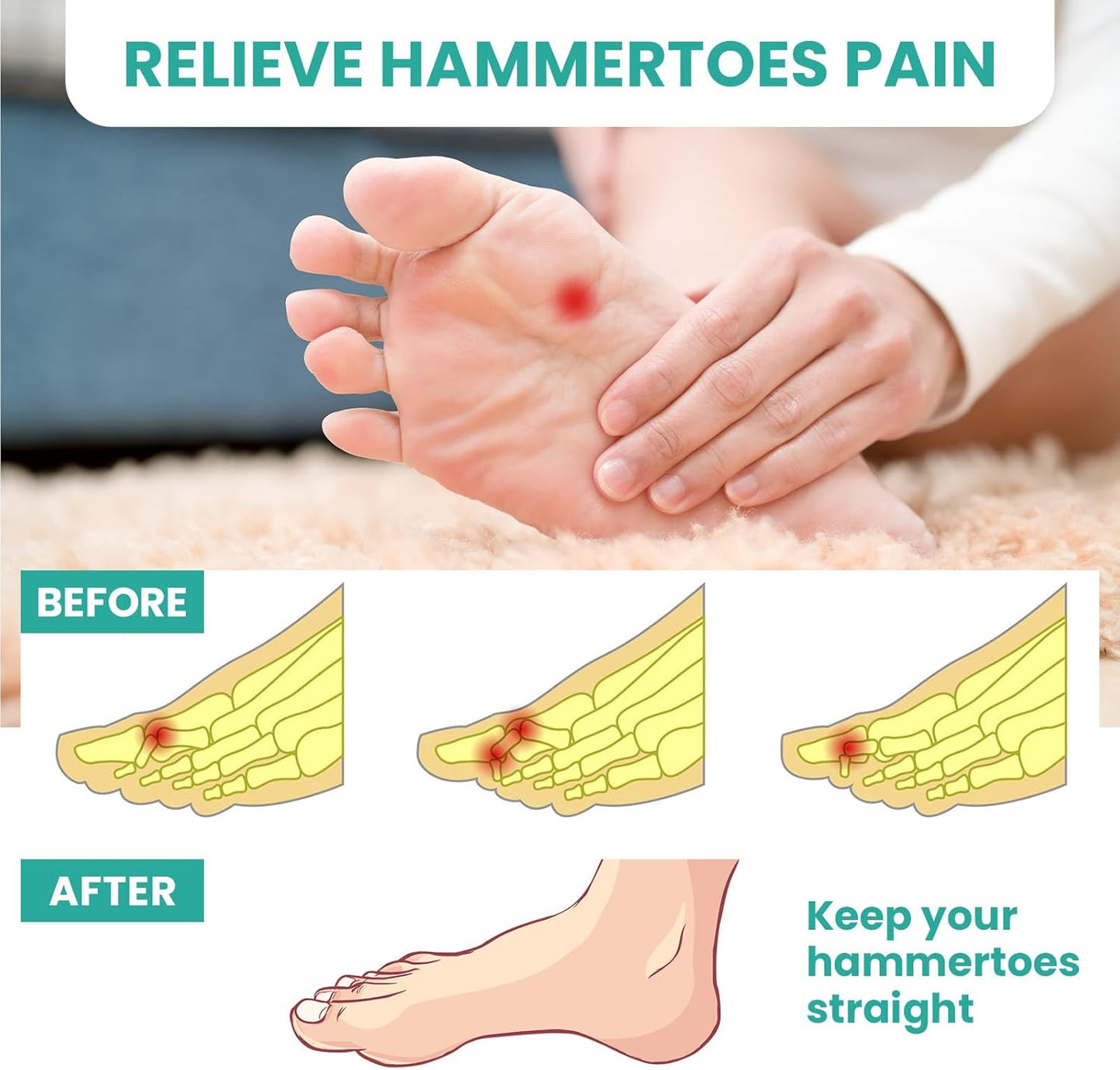Welnove Hammer Toe Straightener Toe Corrector for Women - 8 Pcs Hammer Toe Cushion Pads for Bent, Crooked, Curled, Claw, and Hammer Toes - Soft Support and Realignment(Clear, 3 Loop Design)