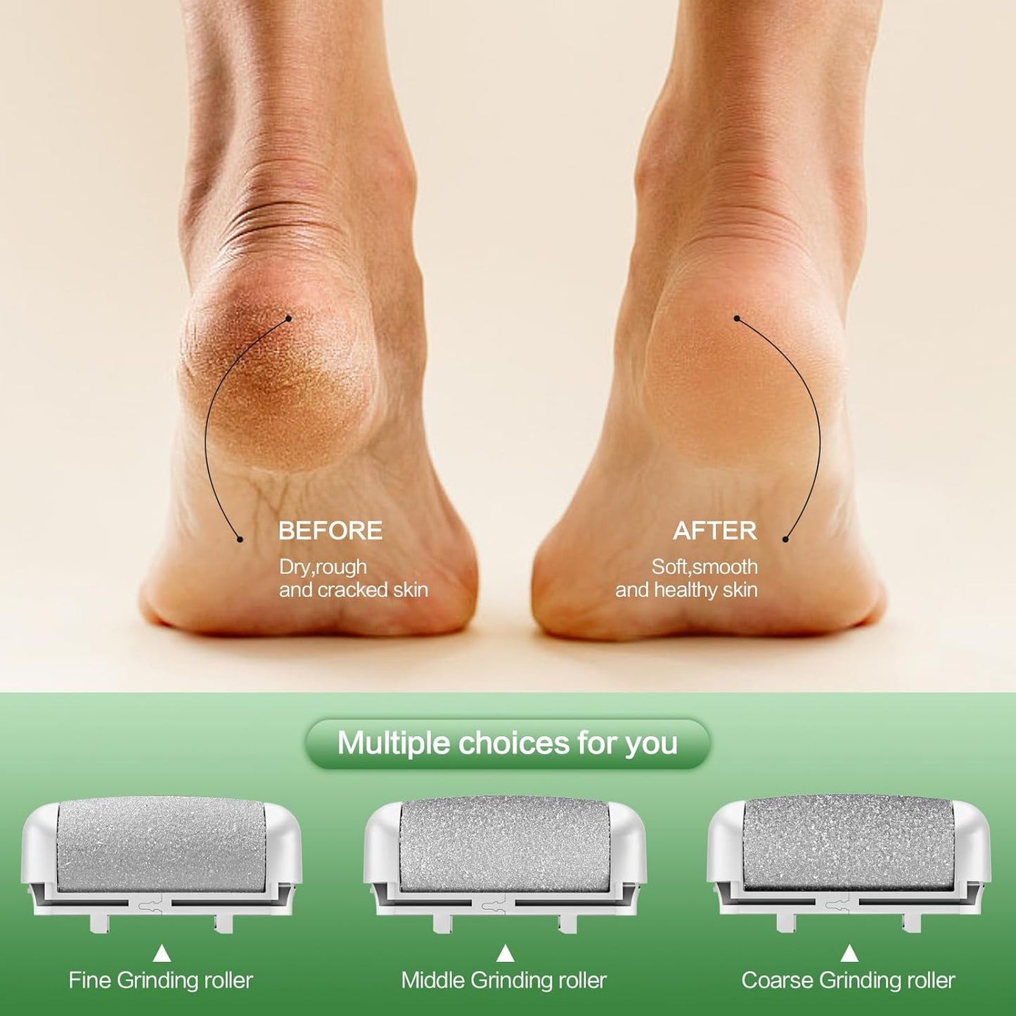 Electric Foot Callus Remover, LED Light & Display Electric Foot File, Rechargeable Waterproof Electric Foot Filer, 3 Replacement Rollers & USB-C Charging Foot Sanders for Feet White
