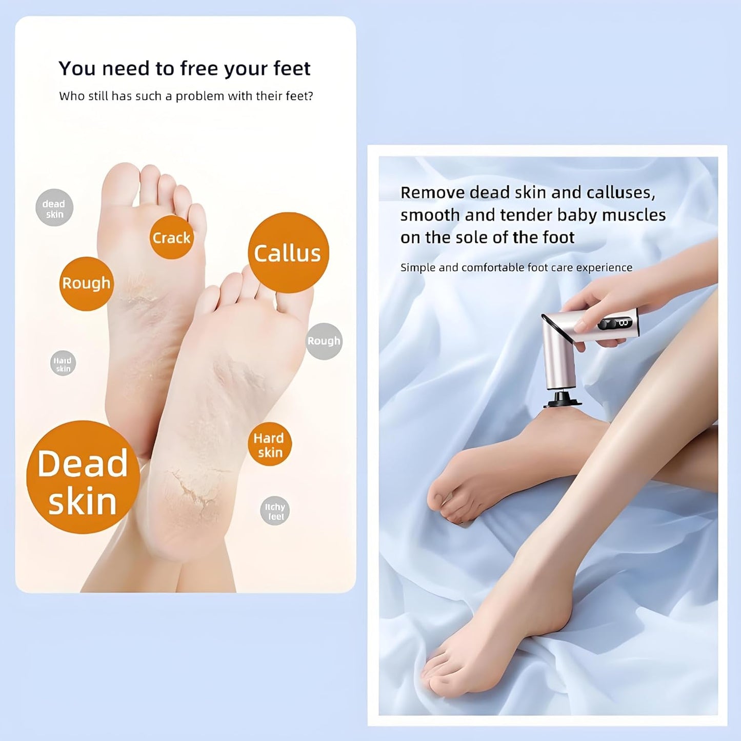 Foldable Electric Foot Callus Remover, Foot Files, 9-Speed Foot Sander Pedicure Tools for Feet Dead Skin with Sandpaper Disk and Nail Care（Rose Gold）