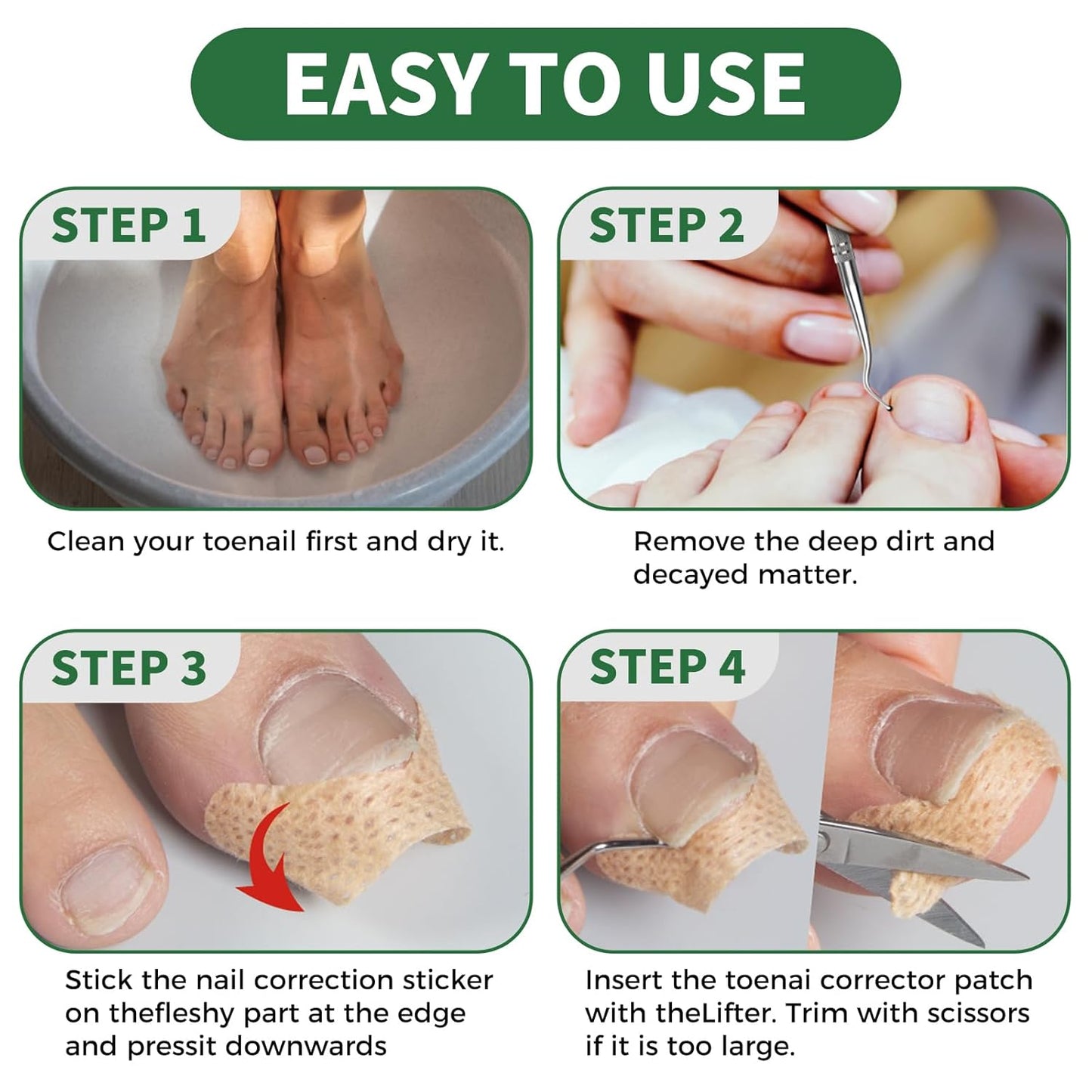 Ingrown Toenail Treatment,100 Pcs Breathable Ingrown Toenail Strips-Toenail Lifter and Small Scissors, Painless Ingrown Toenail Tool, Professional Pedicure for Ingrown Toenail, Toenail Corrector Patch