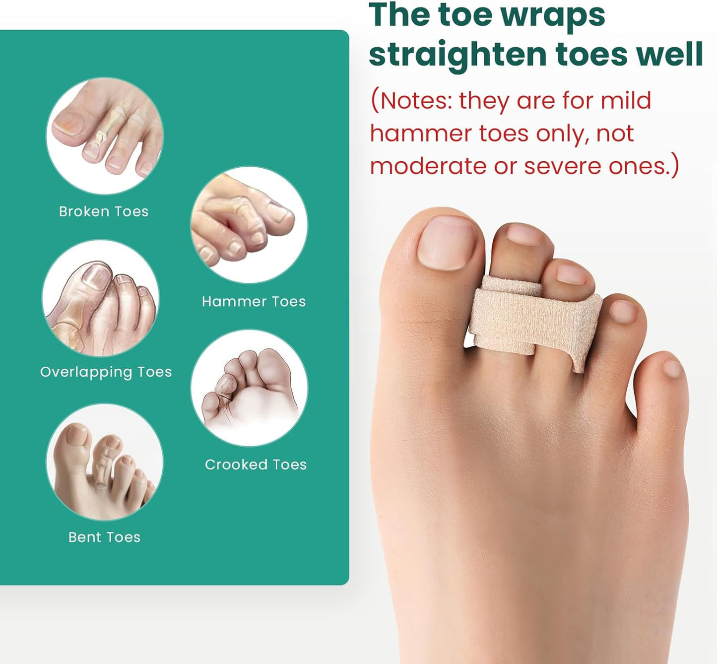 Welnove Hammer Toe Straightener - 8 Pack Broken Toe Wraps - Hammer Toe Corrector for Women - Toe Splints for Crooked Toes, Curled Toes, Bent Toes - (Large, Beige)