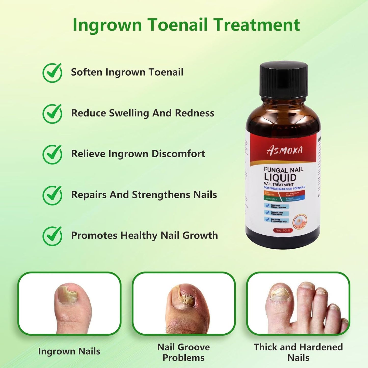 Ingrown Toenail Removal Kit - Professional Ingrown Toenail Treatment Tool Includes Ingrown Toenail Corrector Drops, Corrector Patch, Toenail Clipper, Nail File Lifter Pedicure Tools At Home