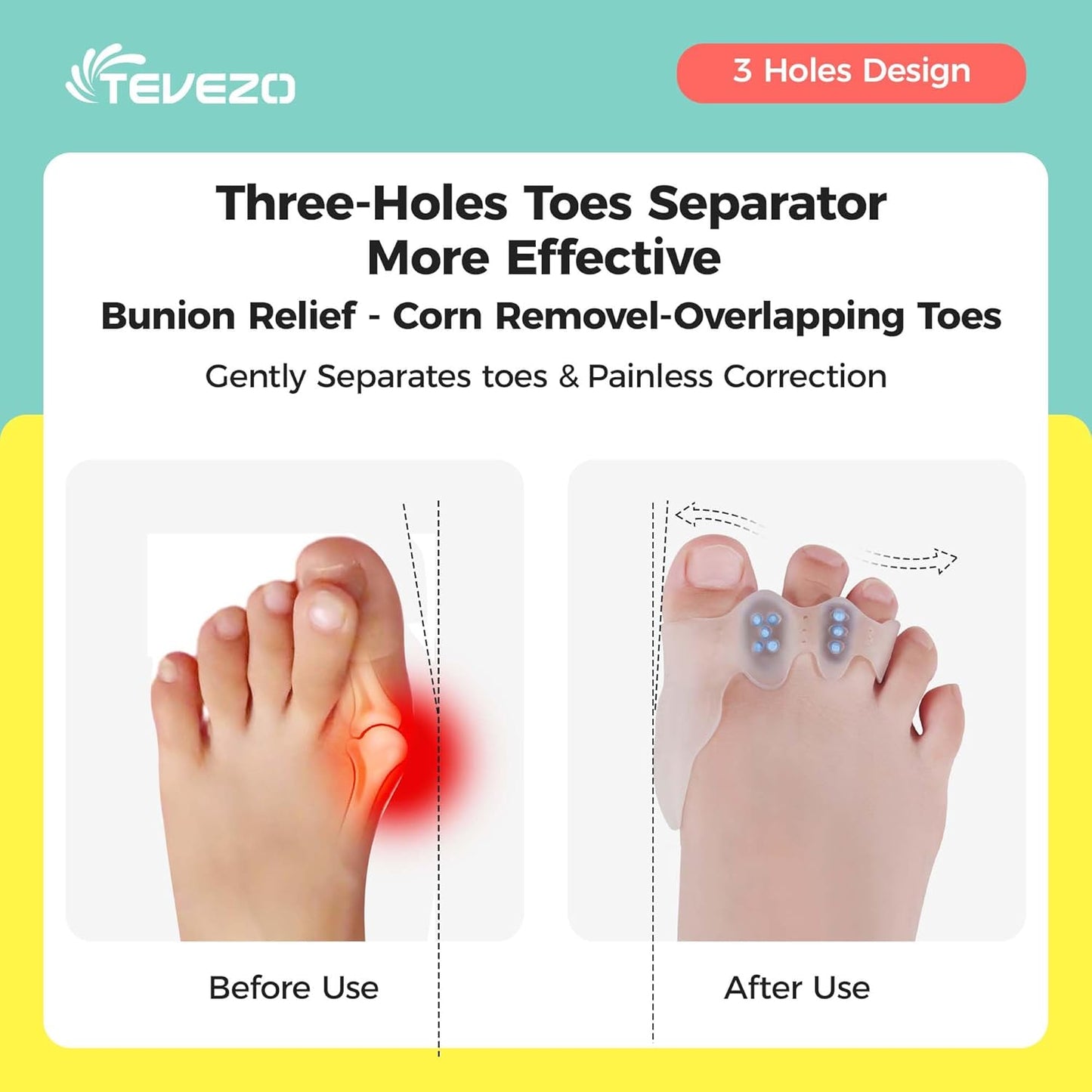 Toe Spacers & Bunion Corrector for Kids | Toe Separators,Corn Callus Removers|Hammer Toe Straightener|Bunion Relief|Overlapping Toes Separators|Corn Pads for Toes|1 Pair (Small-Kids)