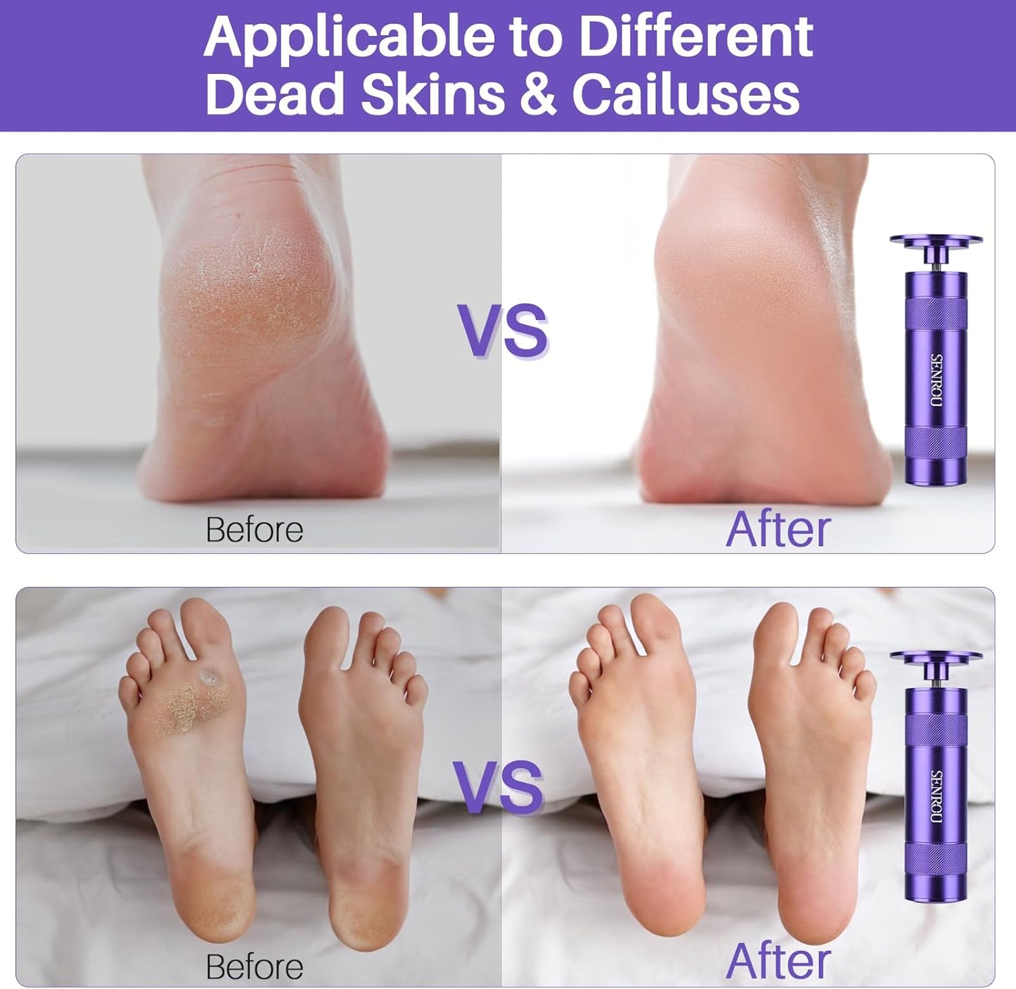 Electric Foot Callus Remover, 2-in-1 Electric Foot Filer/Nail Filer, Callus Remover for Feet with 60Pcs+12Pcs Sandpaper Discs，Holiday Gift Foot Repair Tool, Purple