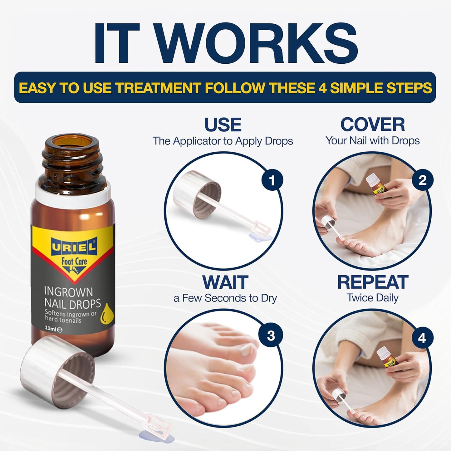 URIEL UPGRADED Ingrown Toenail Treatment, Ingrown Toenail Removal Kit, Ingrown Toenail Corrector, Ingrown Nail Kit Ingrown Toenail Tool 20ml