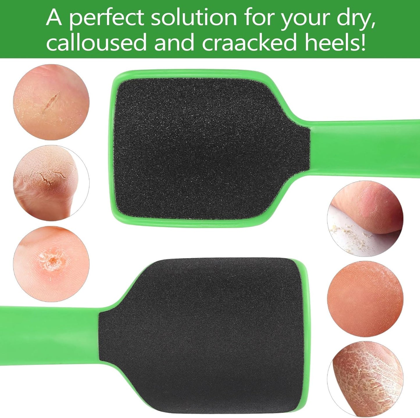 2 Pcs Curved Foot File Callus Remover for Feet, Double Sided Heel File Scraper U Shaped Foot Scrubber Dead Skin Remover