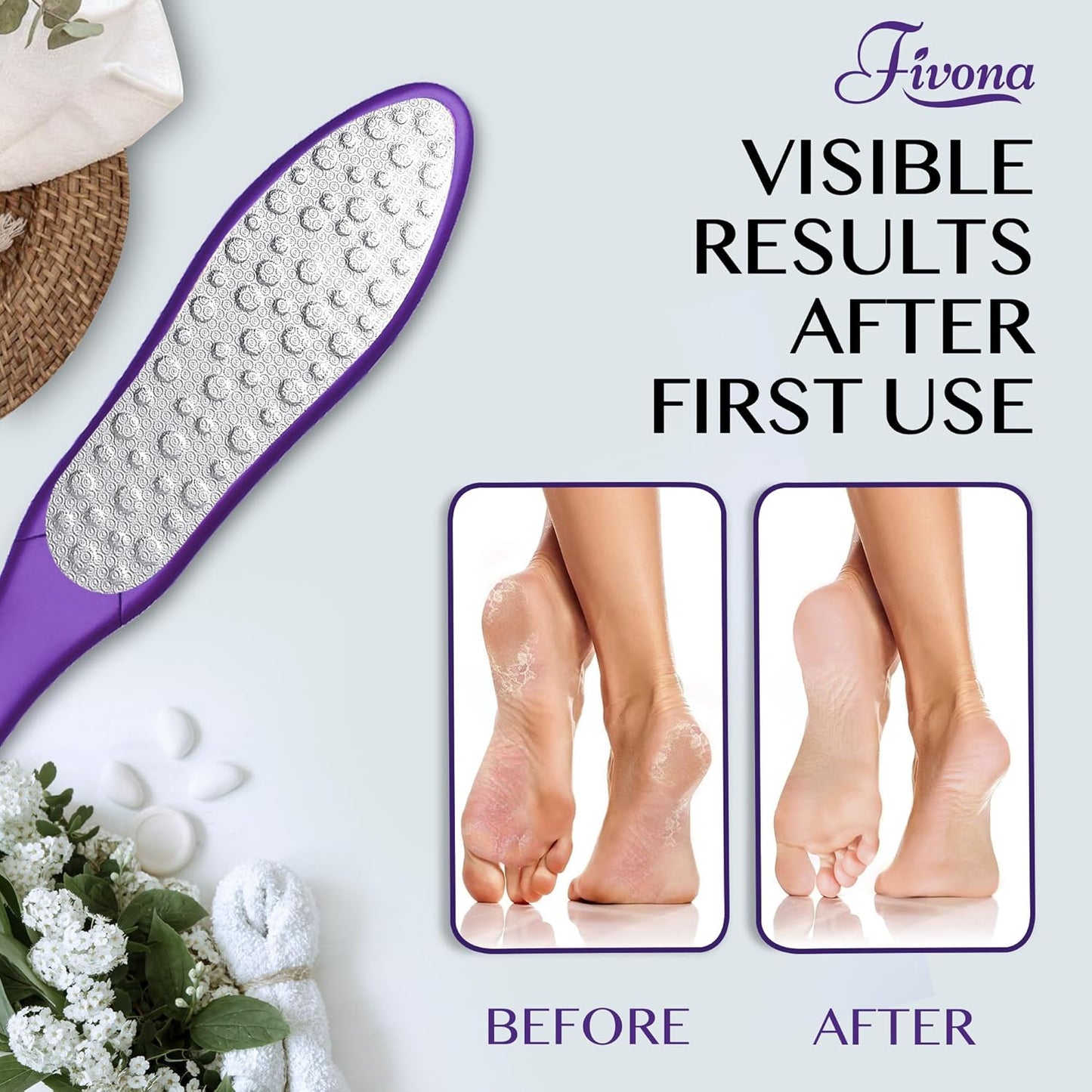 Fivona Foot File - Callus Remover, Double Sided Foot Rasp for Dry Heels, Feet Scrubber for Dead Skin, Foot Scraper for Corn Removal