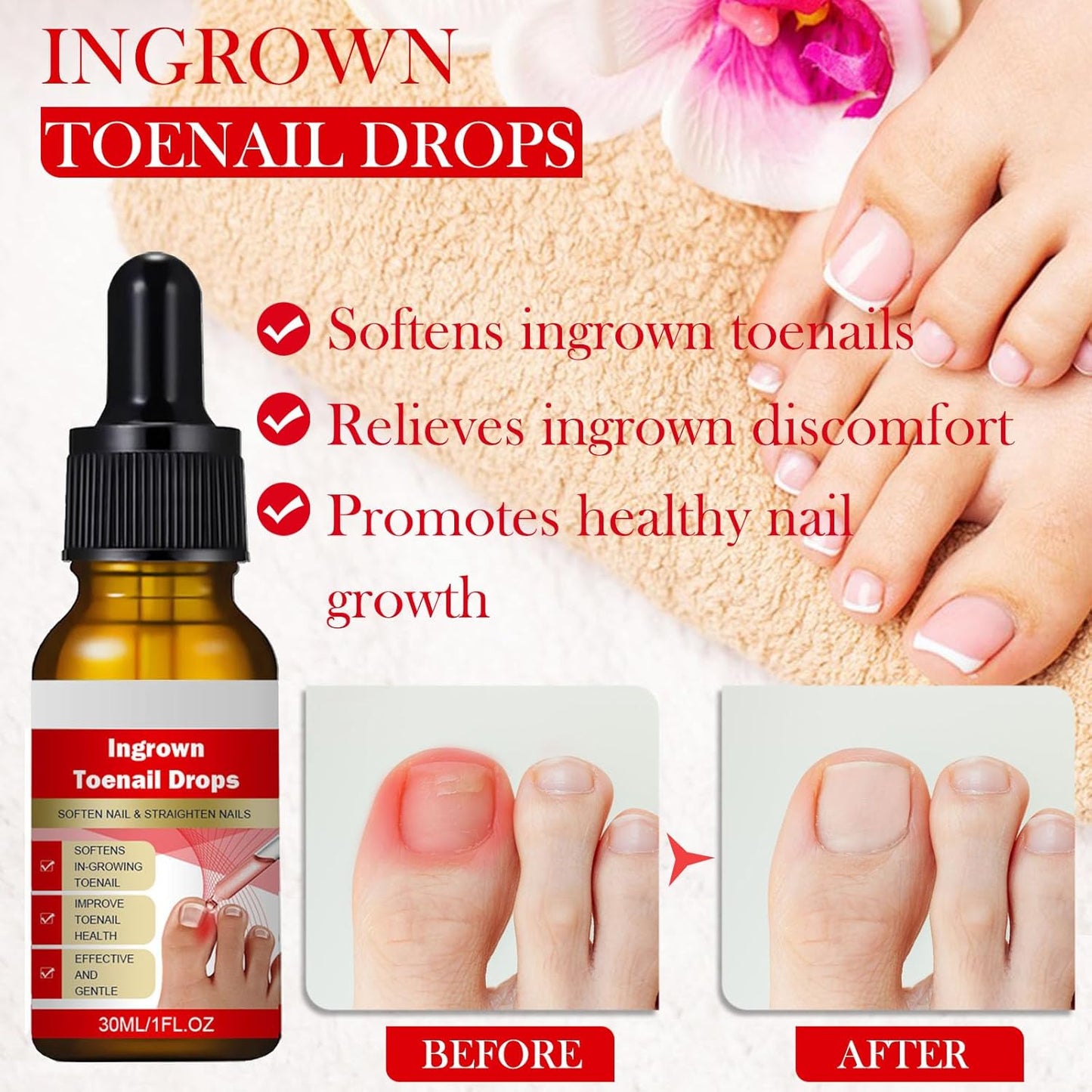 Ingrown Toenail Removal Kit, Professional Ingrown Toenail Treatment, Ingrown Toenail Tools Kit with Ingrown Toenail Corrector Drops, Toenail Clipper, Corrector Patch, Stainless Steel Pedicure Tool Set