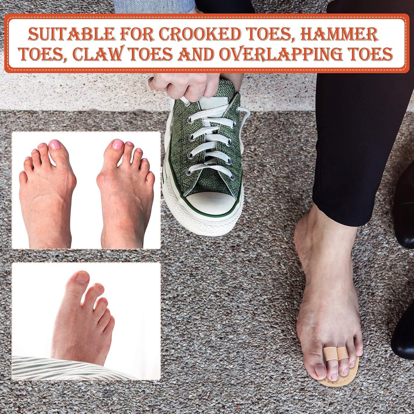 Nuanchu 6 Pieces Double Toe Straightener Hammer Toe Splint Corrector Separators for Crooked Relieving Foot Pain, Claw and Overlapping, Pressure, Discomfort
