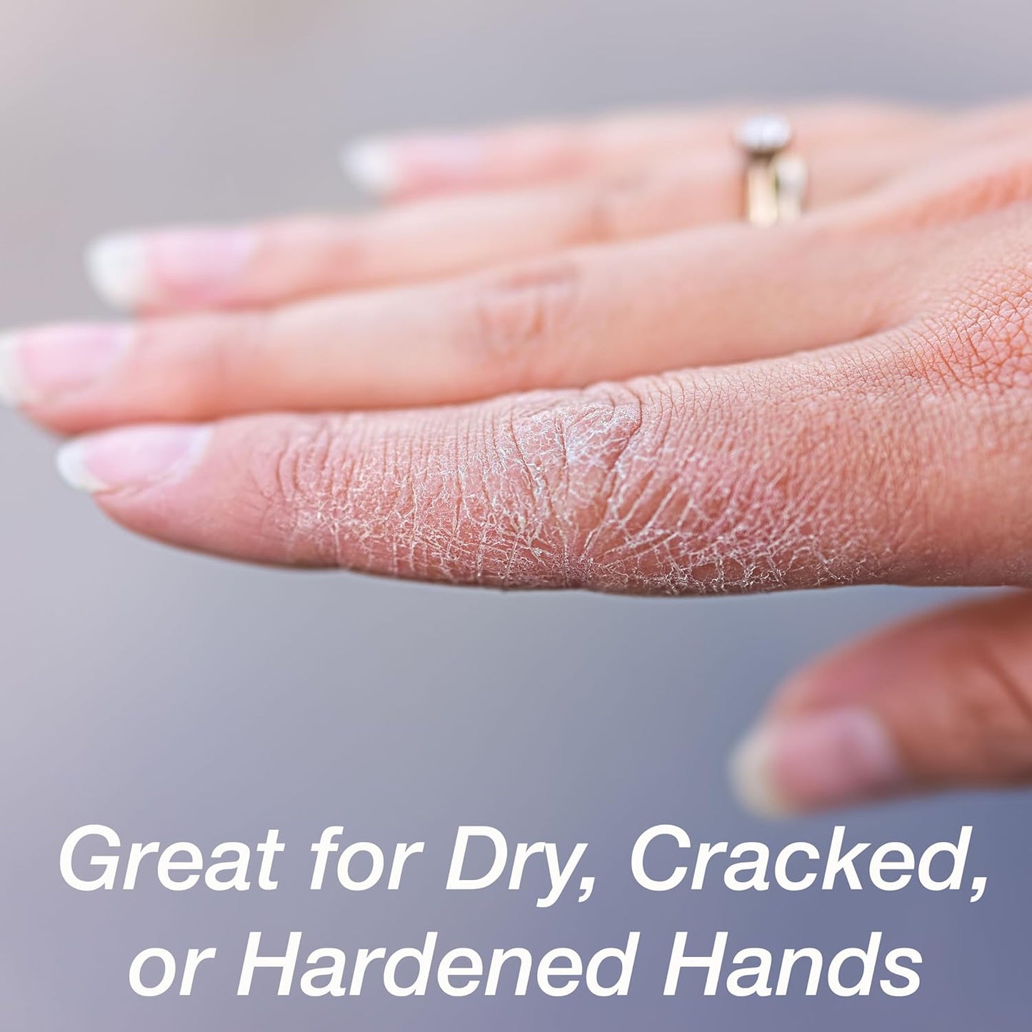 Gel Spa Moisturizing Gloves - 1 Pair Spa Gloves Infused with Essential Oils to Soften Skin & Lock in Moisture | Gel Gloves for Dry, Cracked Hands