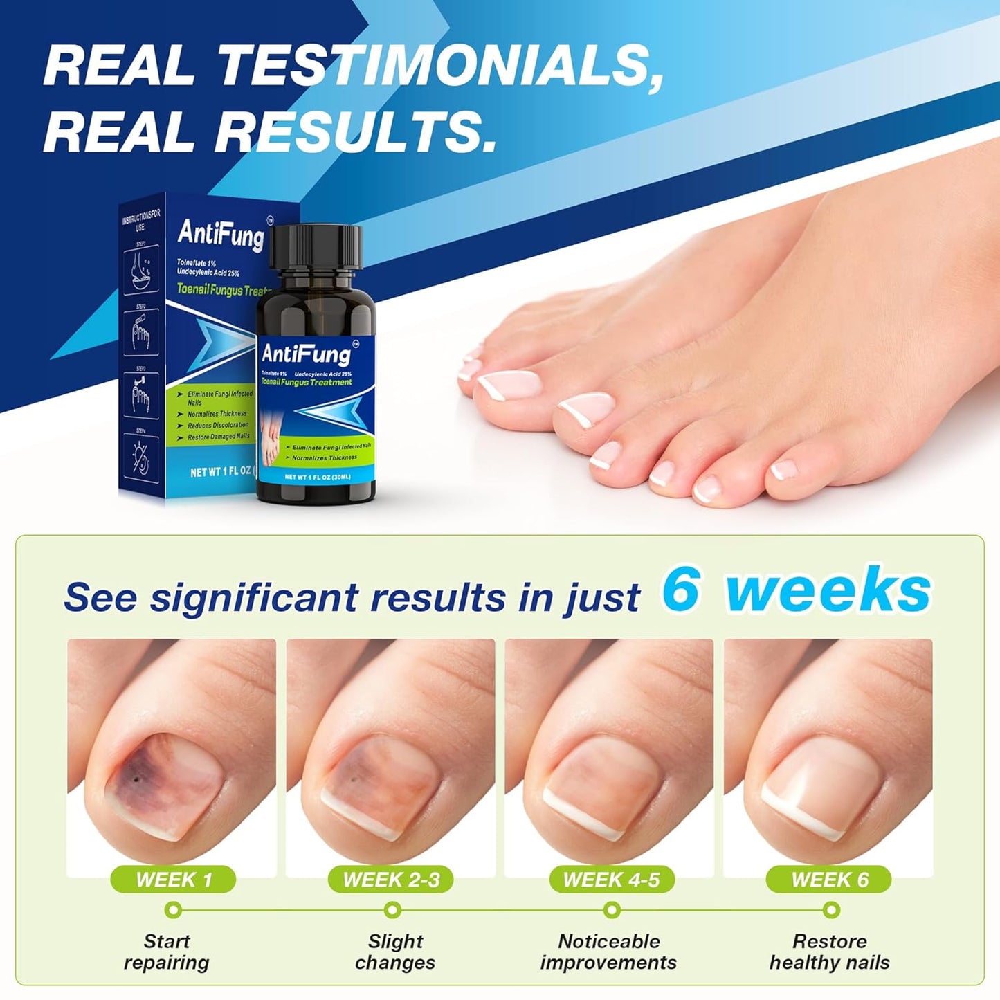 Toenail Fungus Treatment Extra Strength – Nail Repair for Damaged Nails, Thick, Yellow, and Discolored Toenails – Fast Acting Formula for Fungus Relief with Tea Tree Oil, 30ml / 1oz