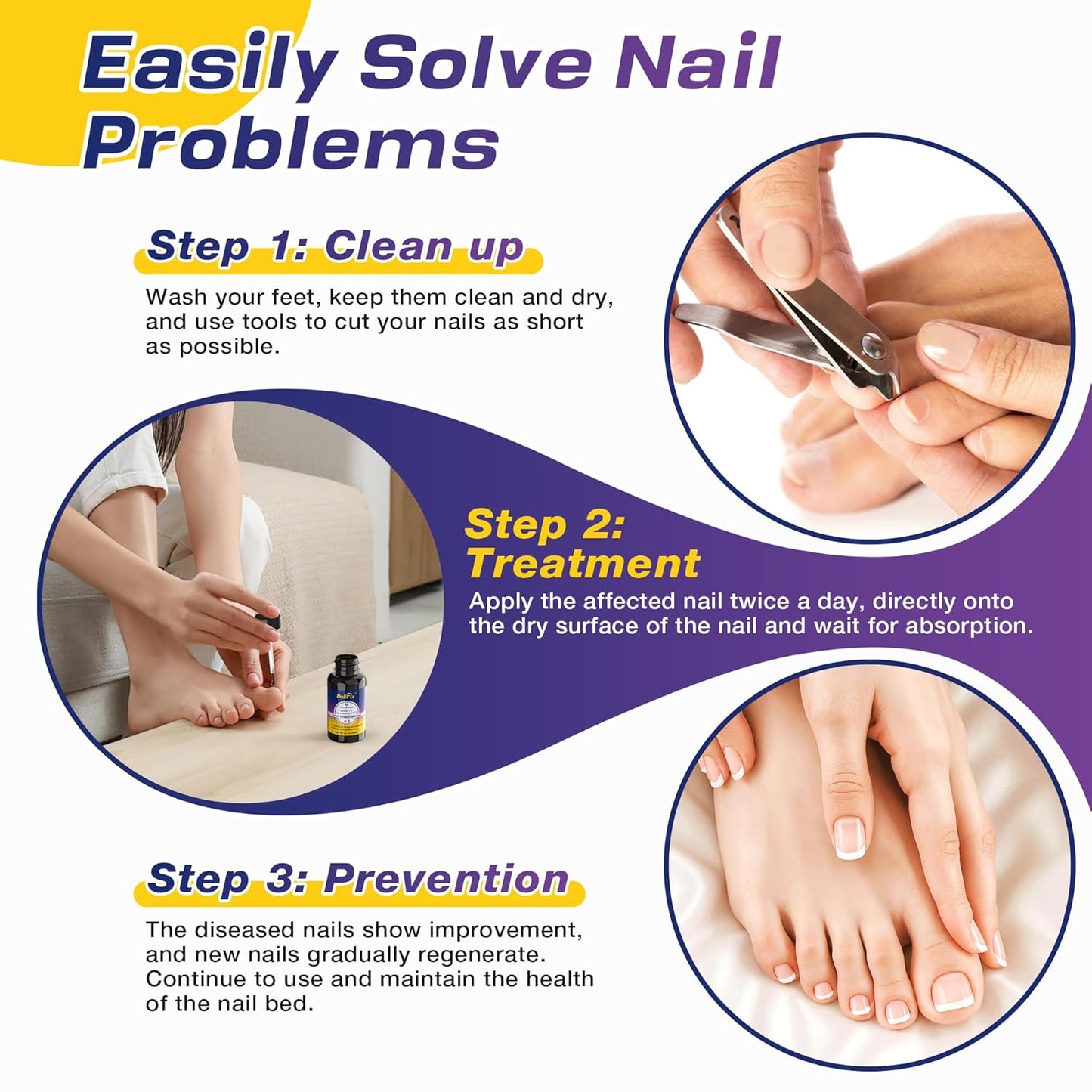 Toenail Fungus Treatment Extra Strength - Upgraded Toe Nail Fungus Treatments, Antifungal Nail Treatment with 25% Undecylenic Acid & Tea Tree Oil - Damaged Nails Foot Fungus Treatment Extra Strength